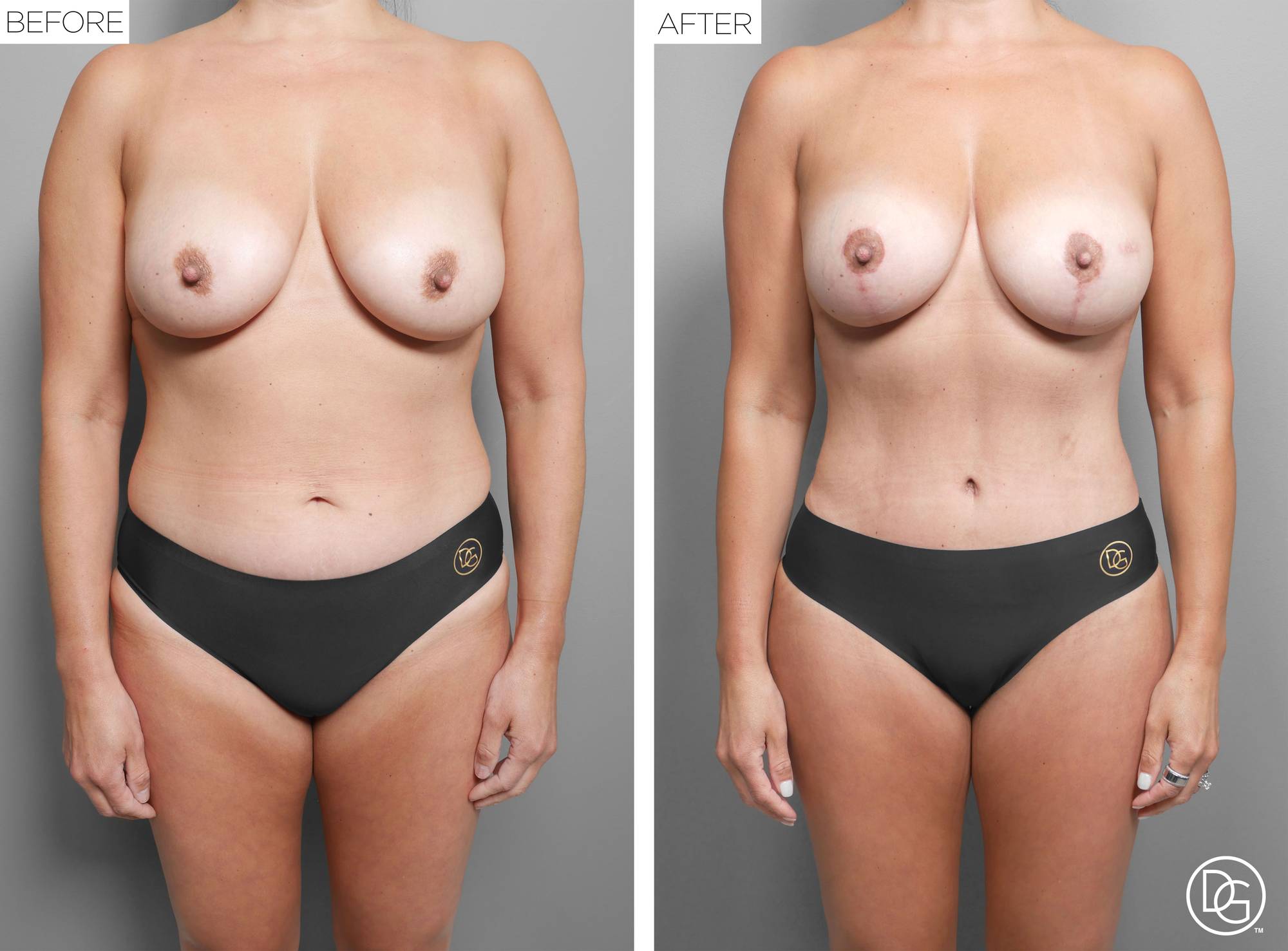 Before & After Image