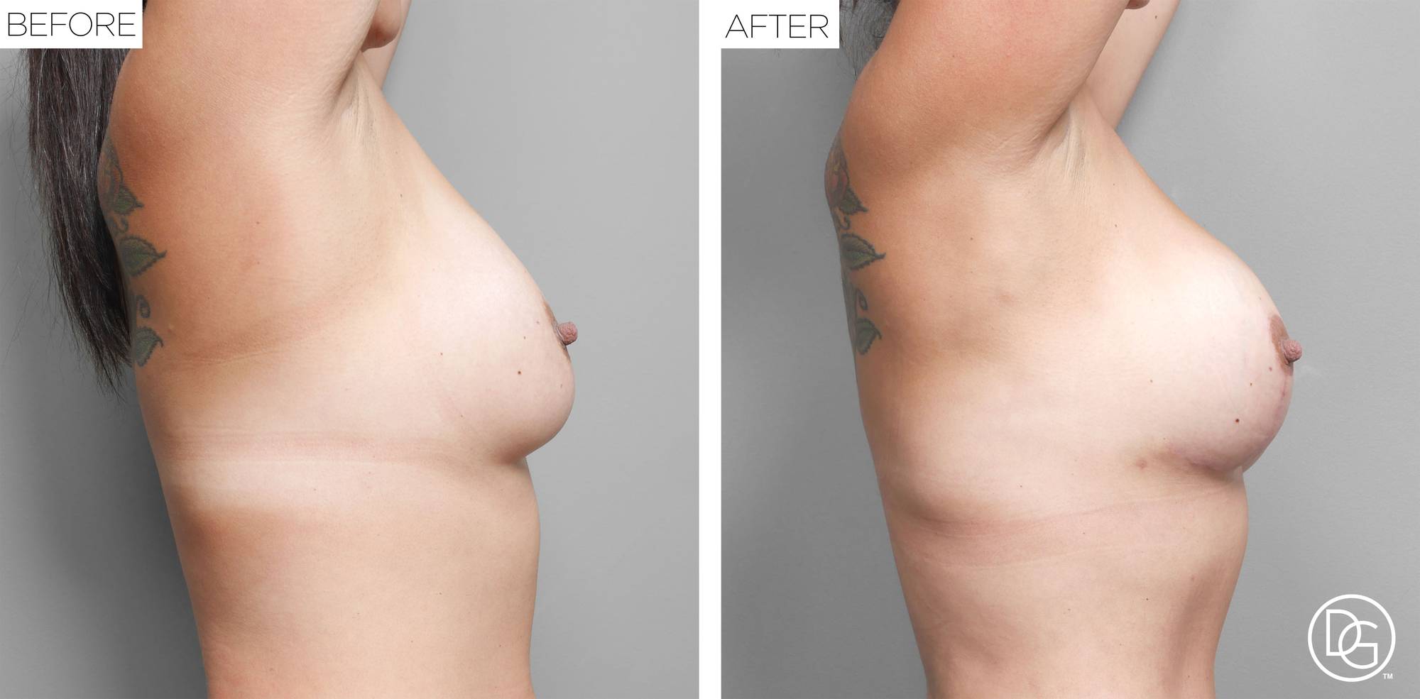 Before & After Image