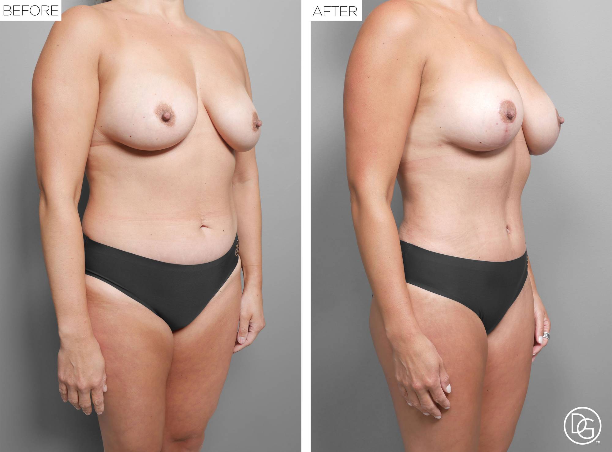 Before & After Image