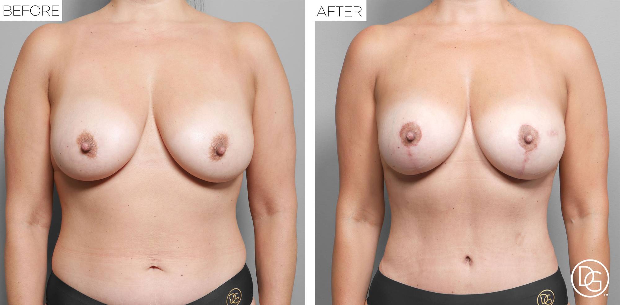 Before & After Image