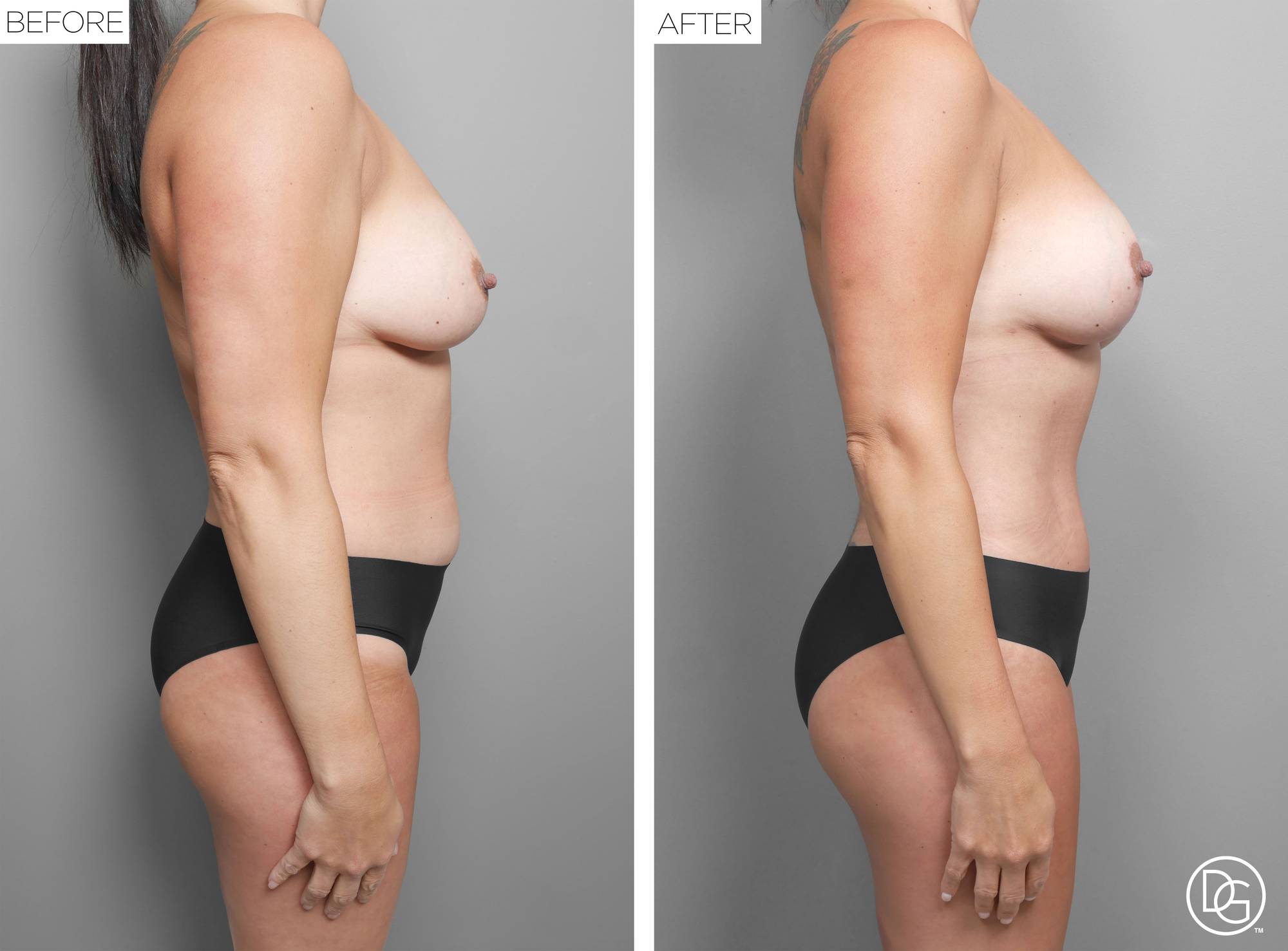 Before & After Image