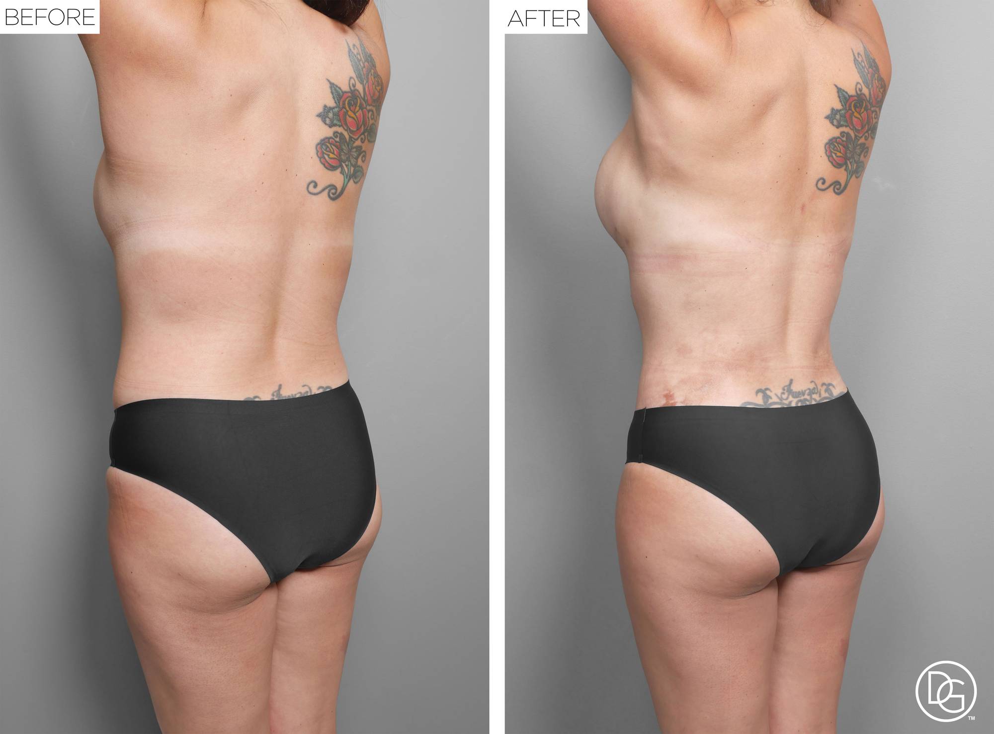 Before & After Image