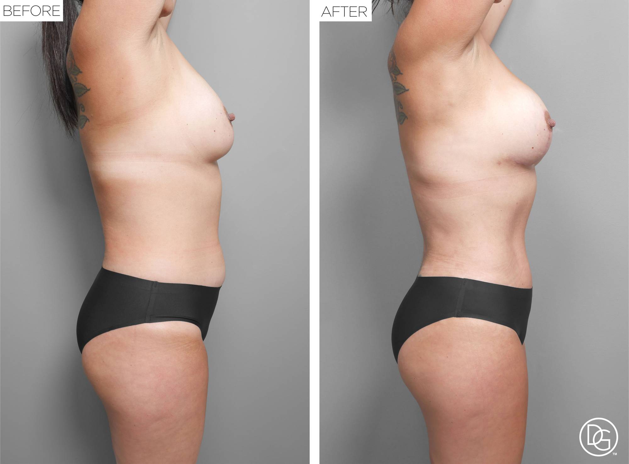 Before & After Image