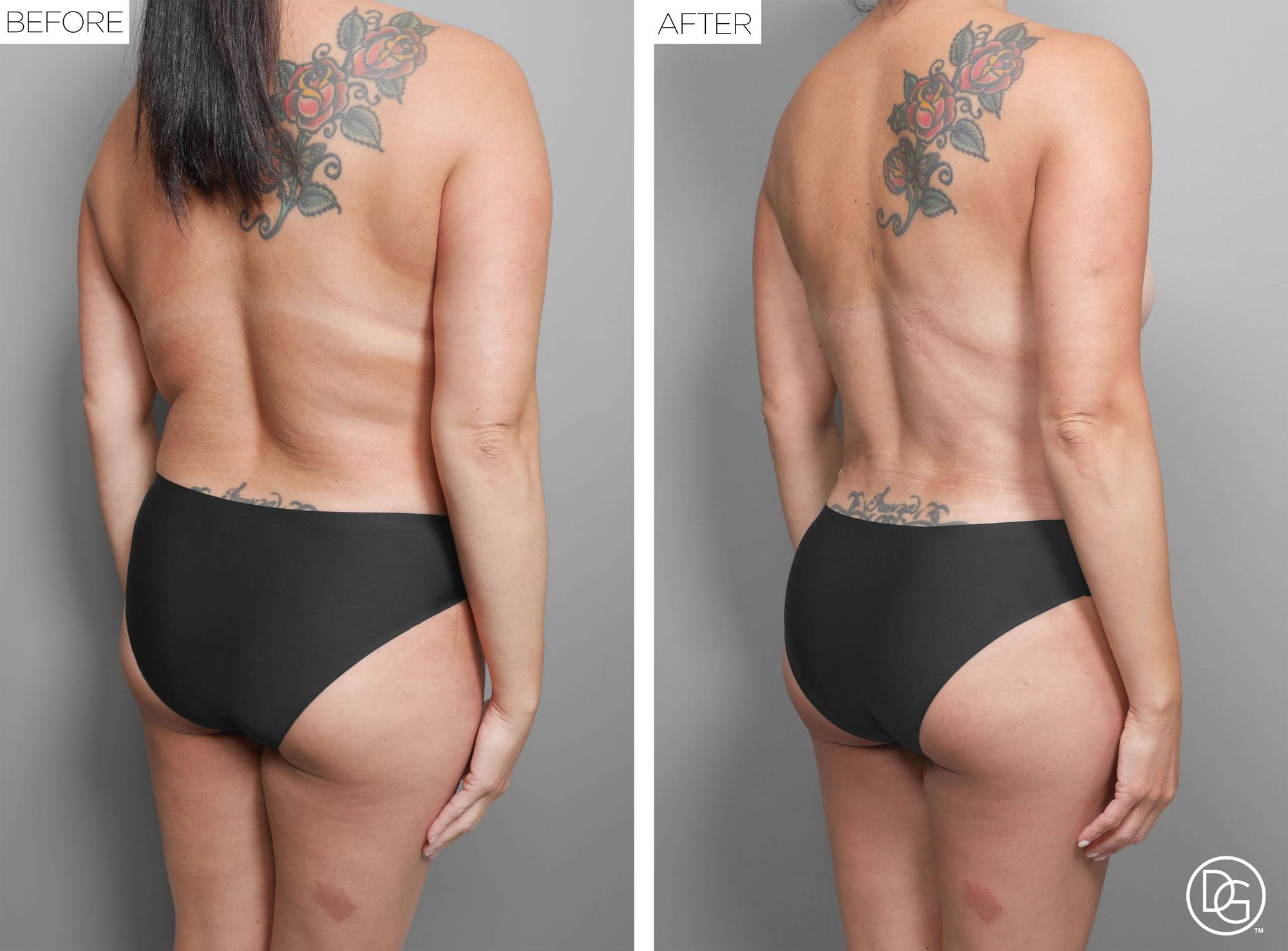 Before & After Image