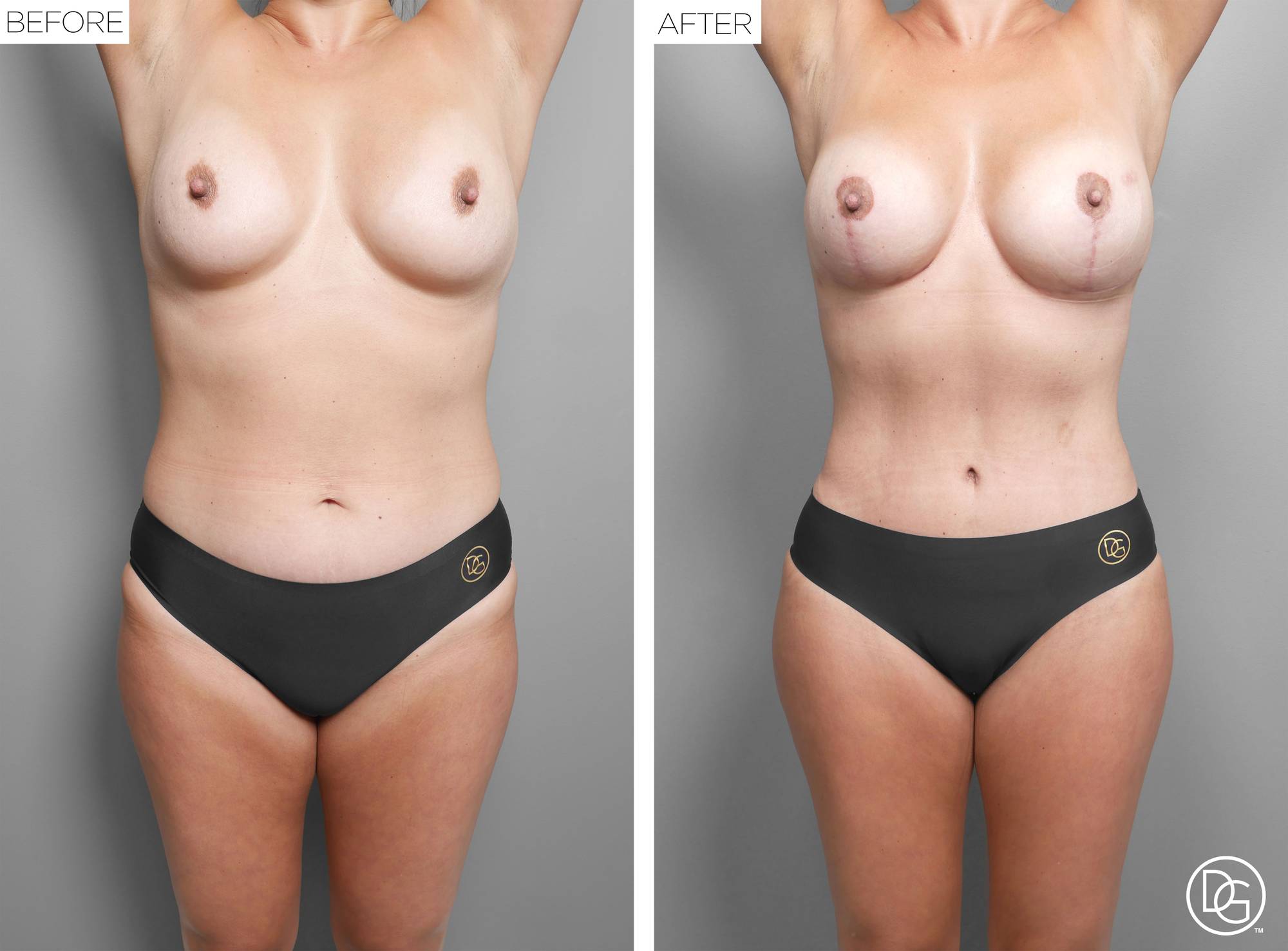 Before & After Image