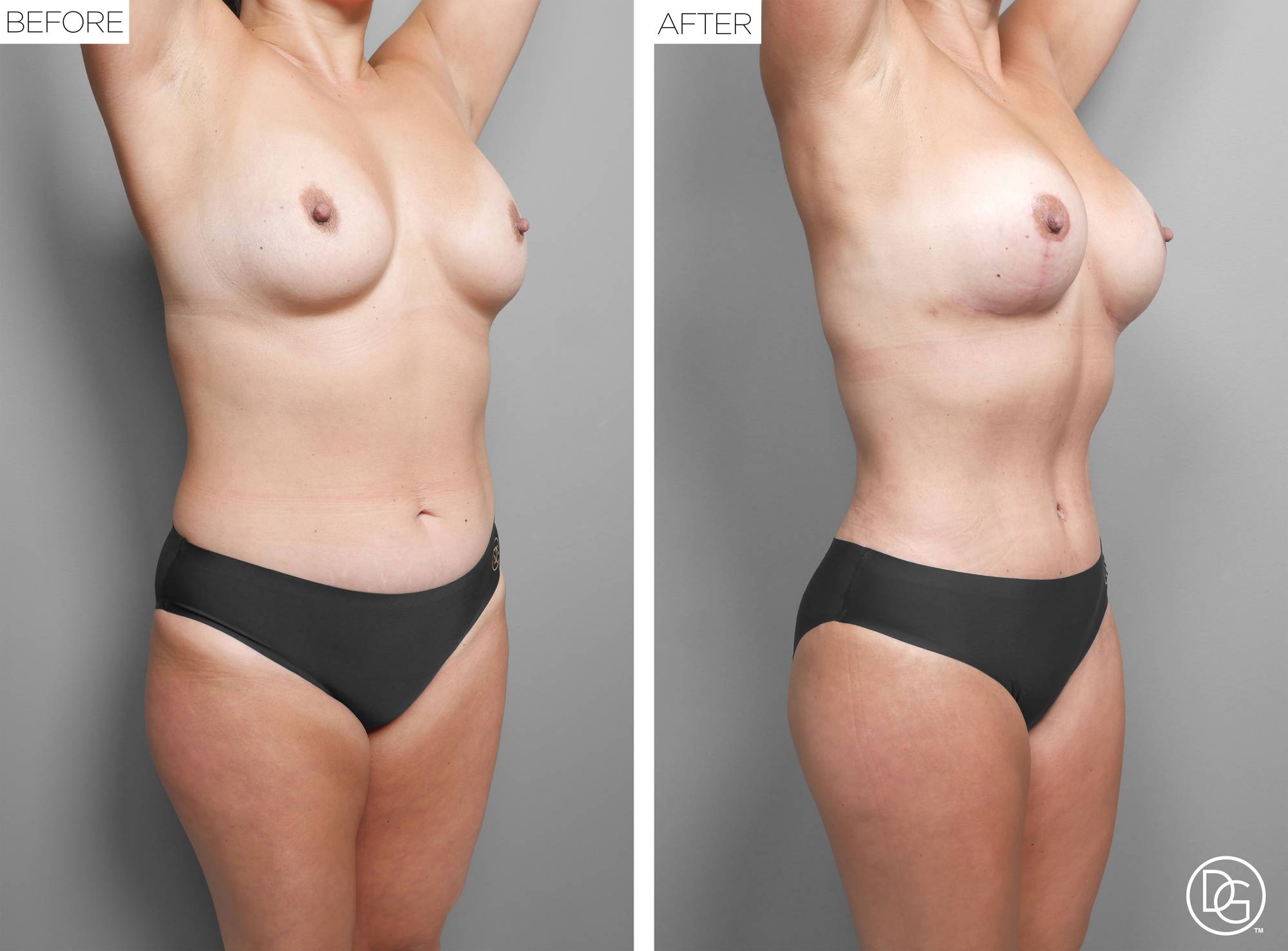 Before & After Image