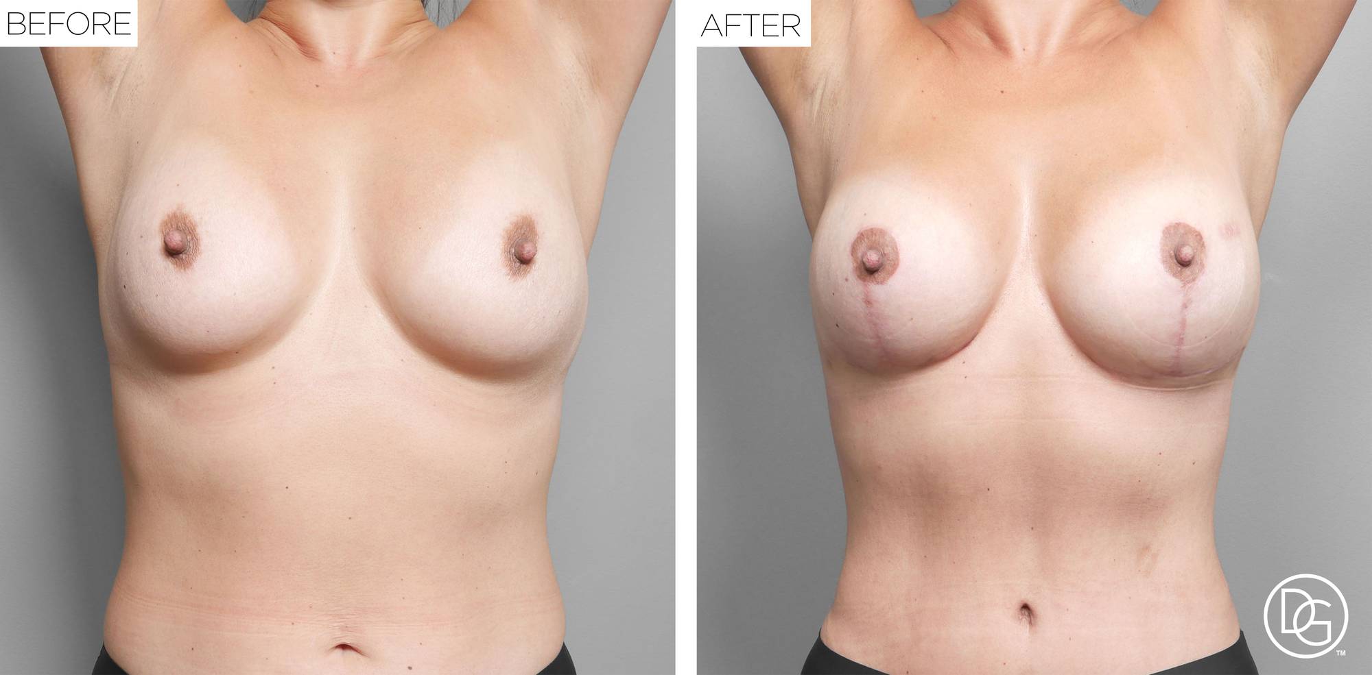 Before & After Image