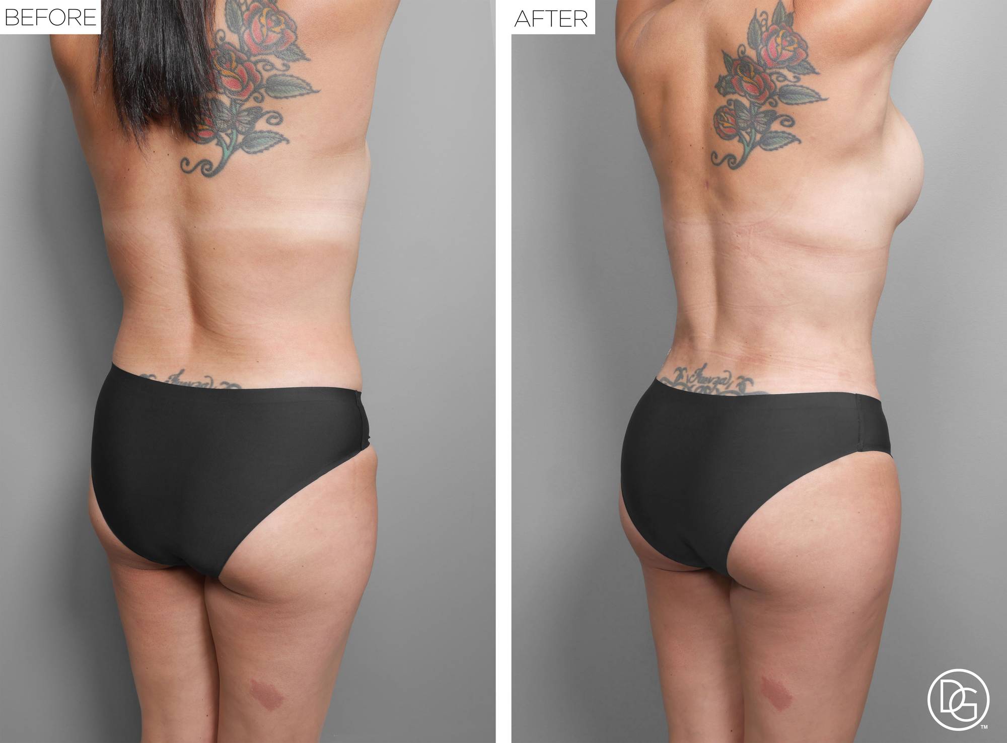 Before & After Image