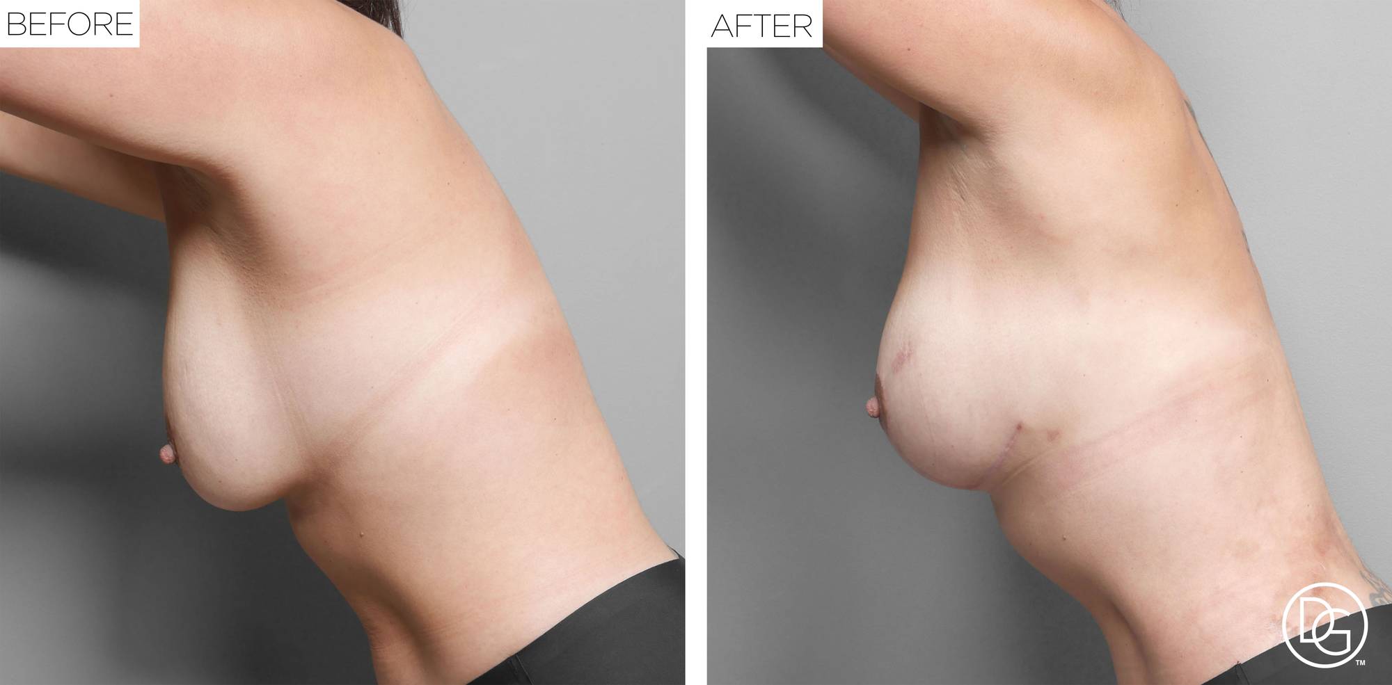 Before & After Image