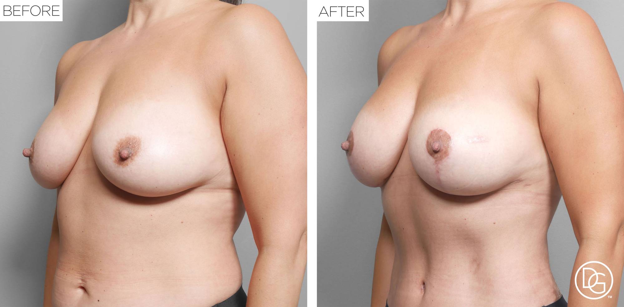 Before & After Image