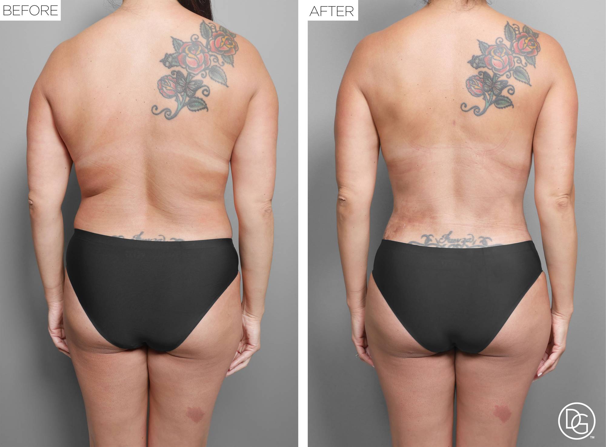 Before & After Image