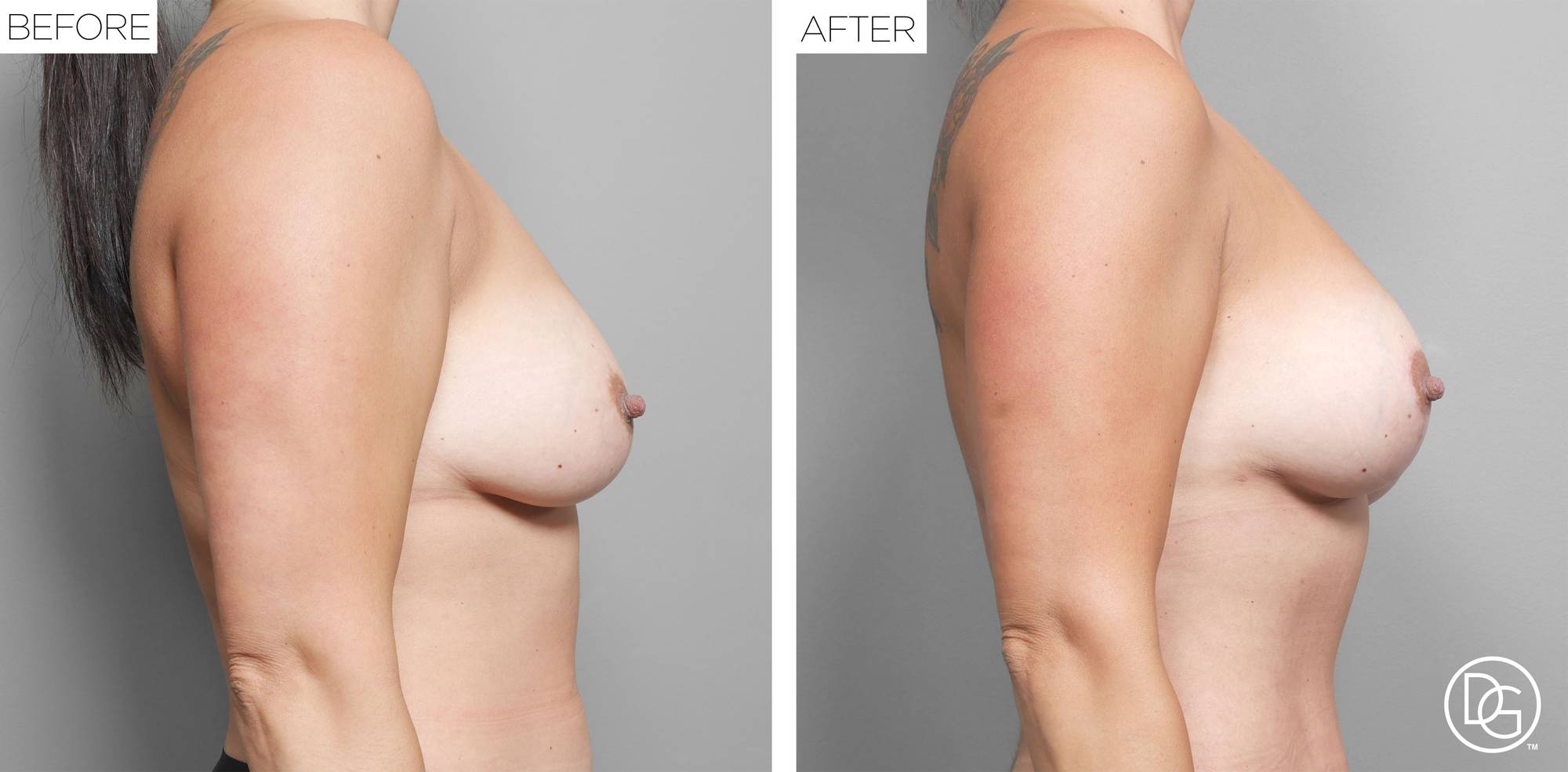 Before & After Image