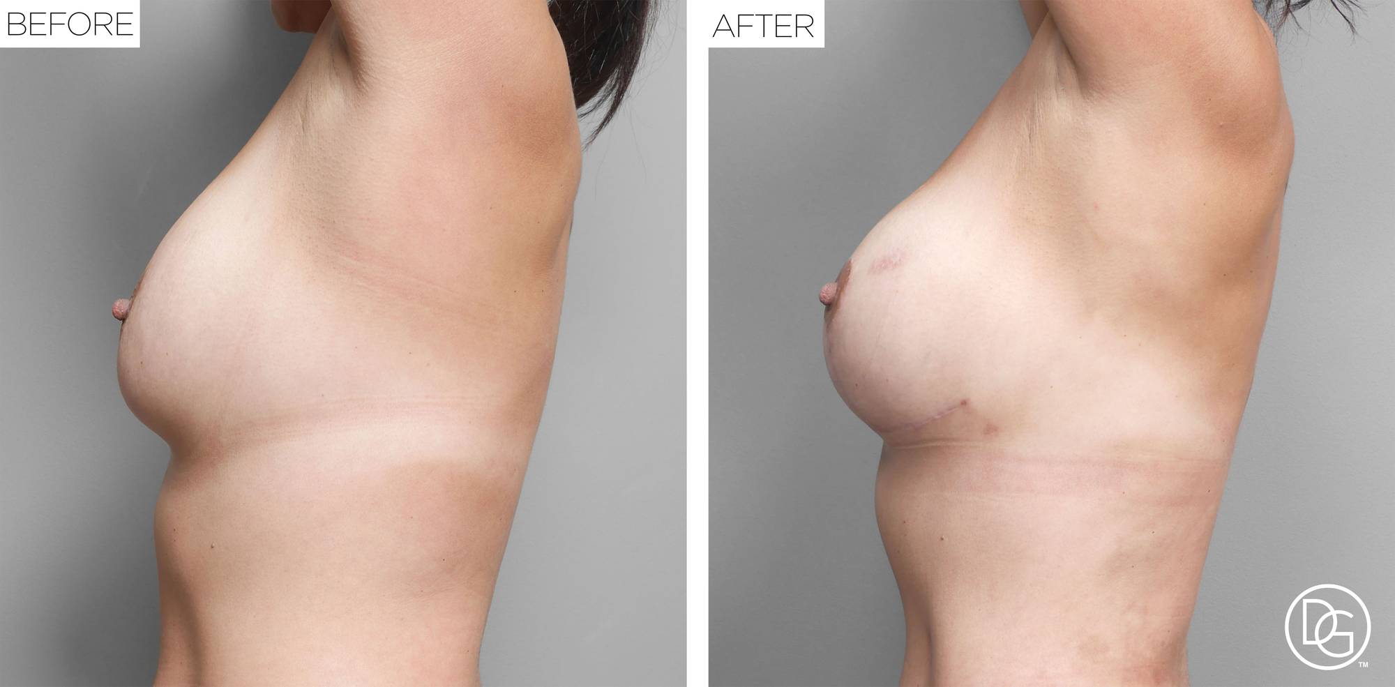 Before & After Image