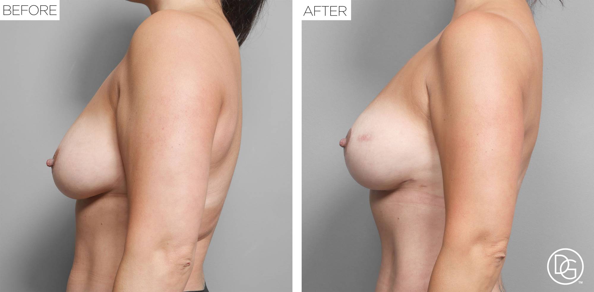 Before & After Image