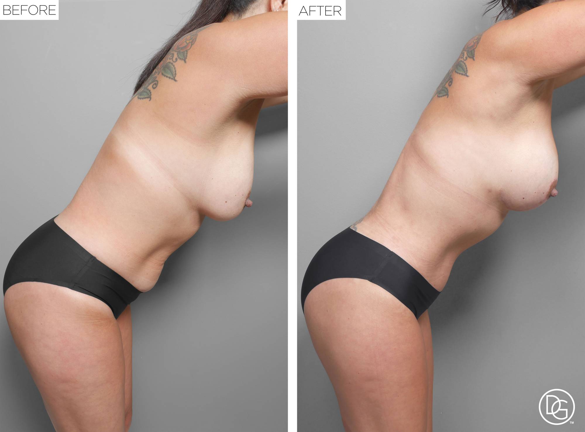 Before & After Image