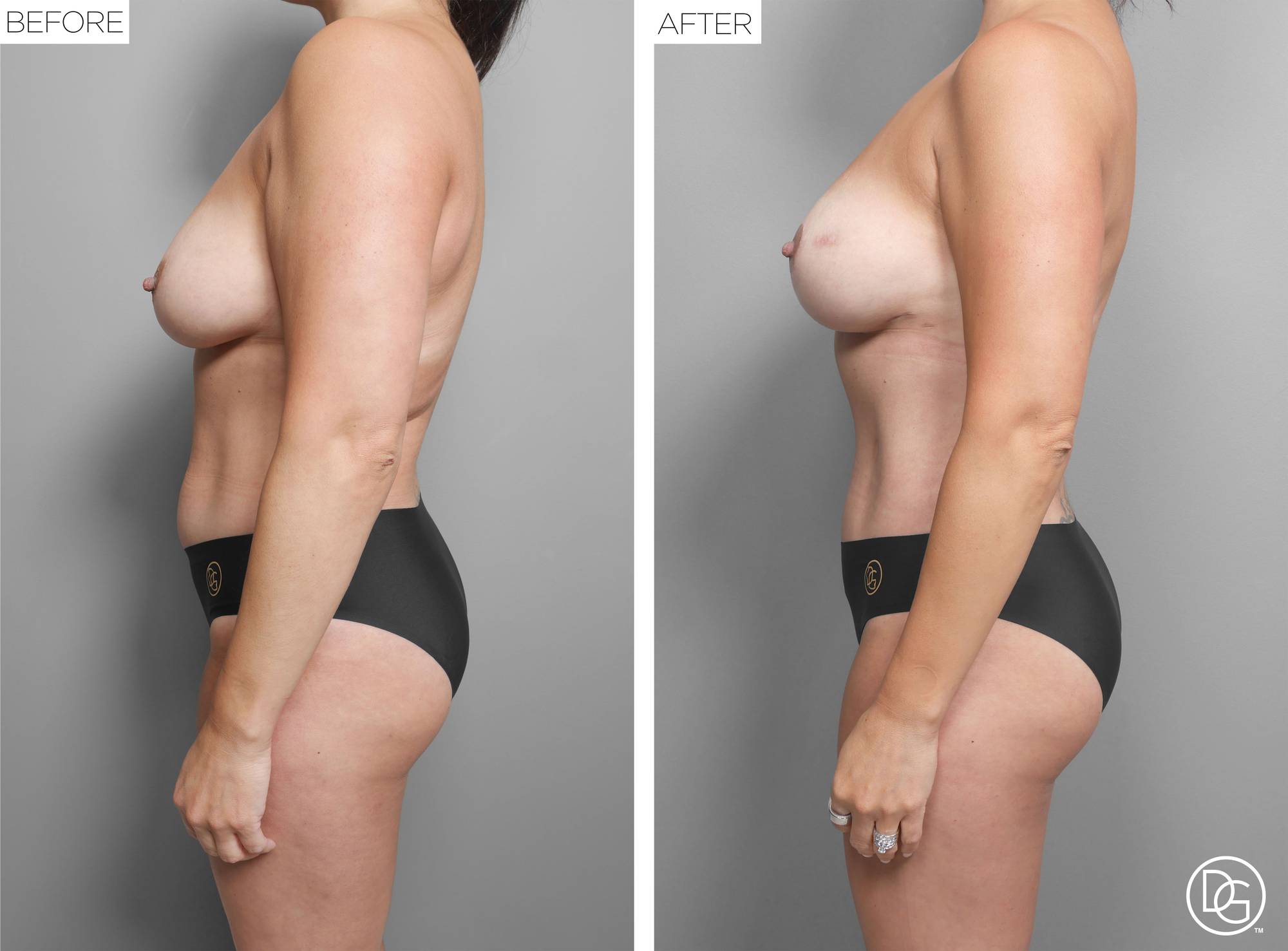 Before & After Image