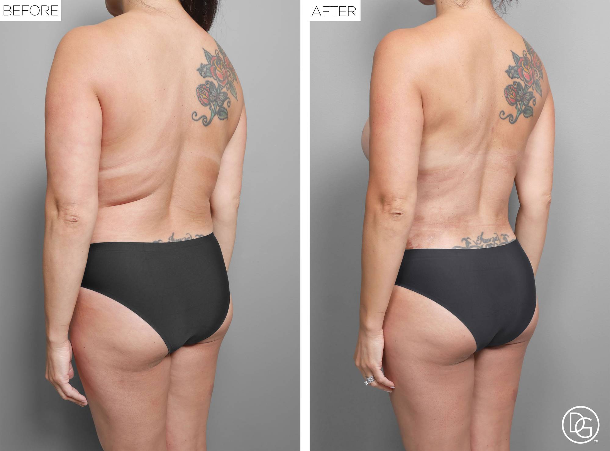 Before & After Image