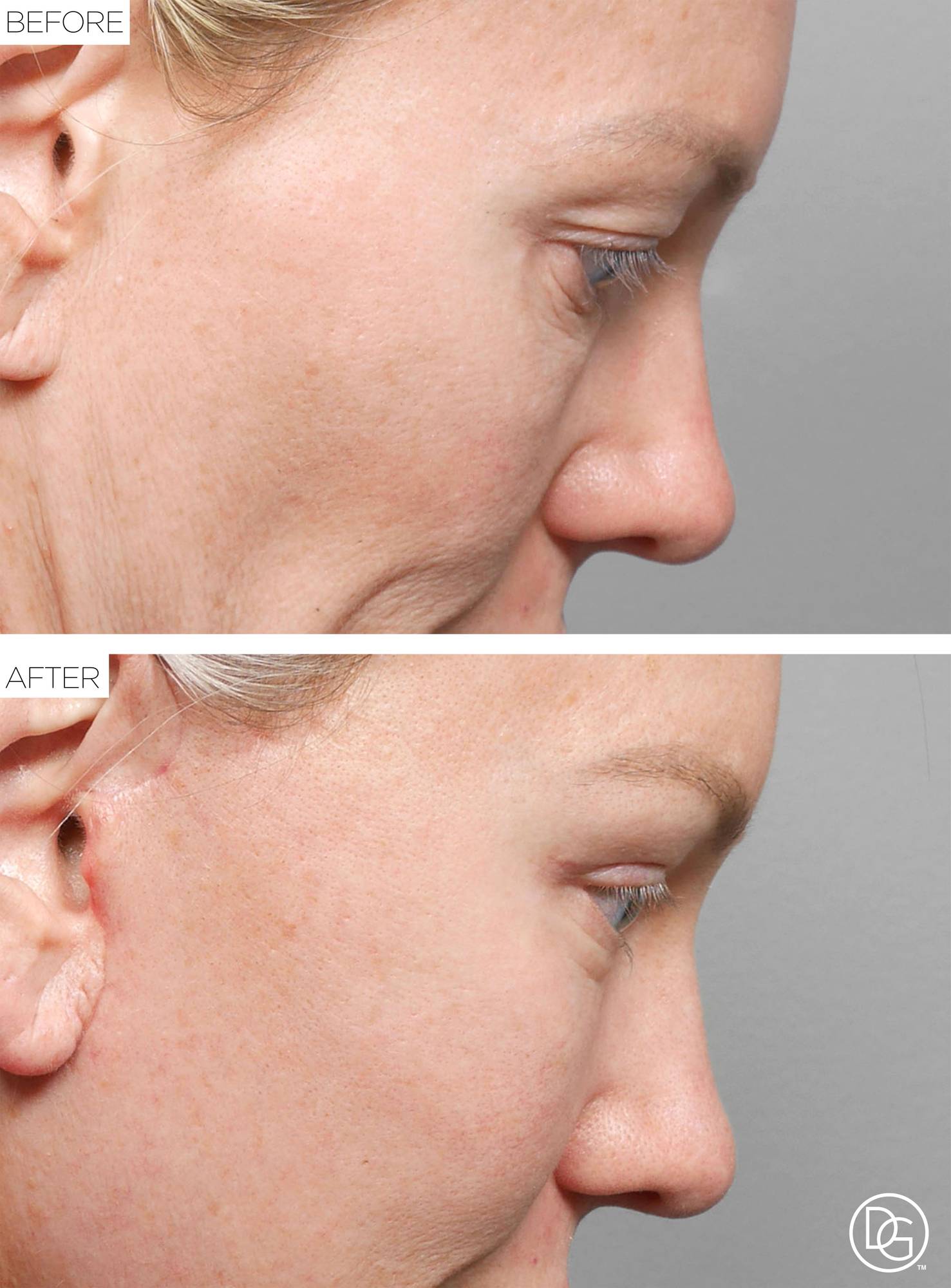 Before & After Image