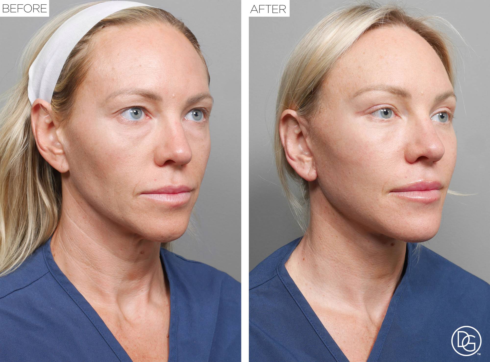 Before & After Image
