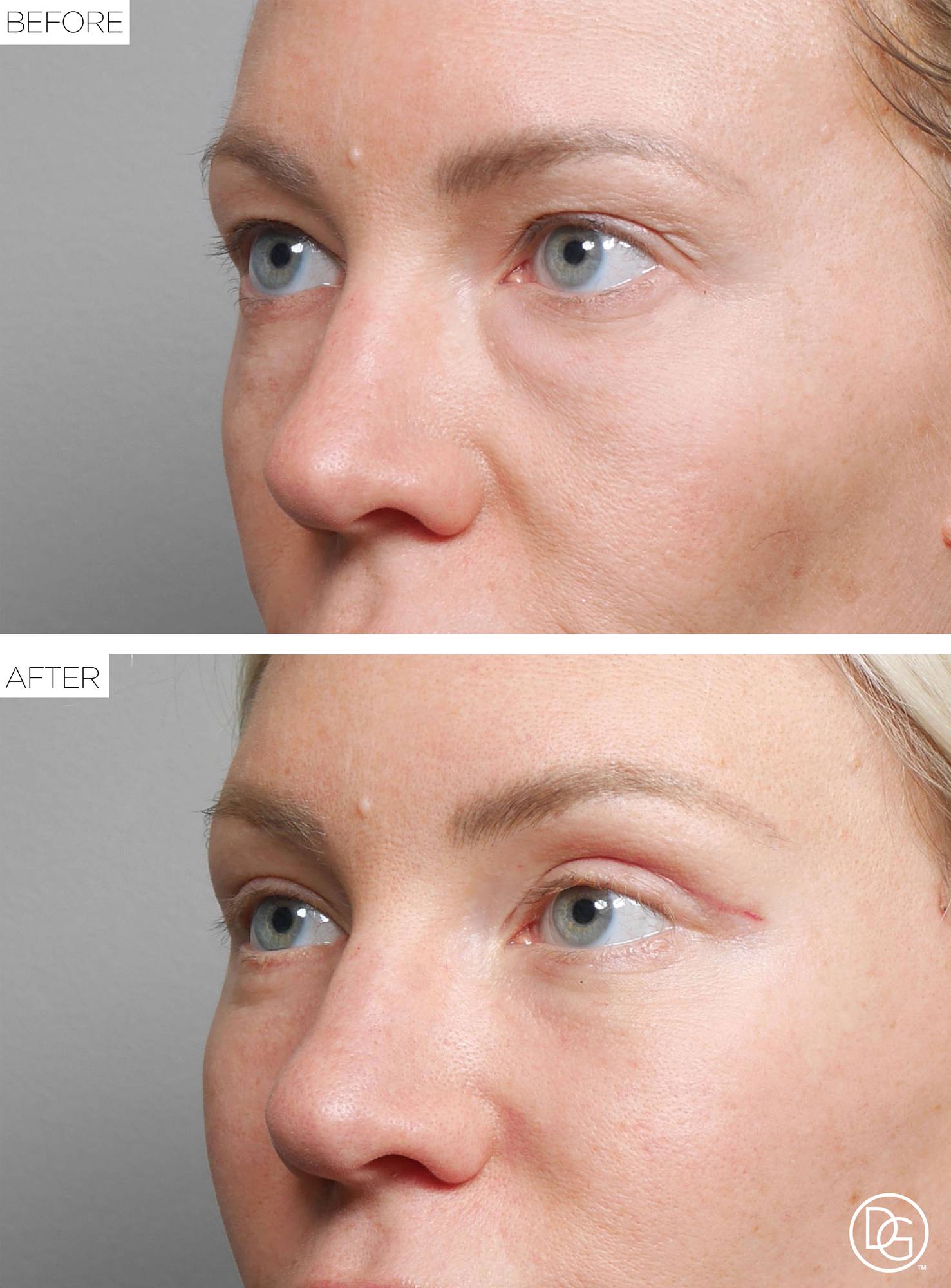 Before & After Image