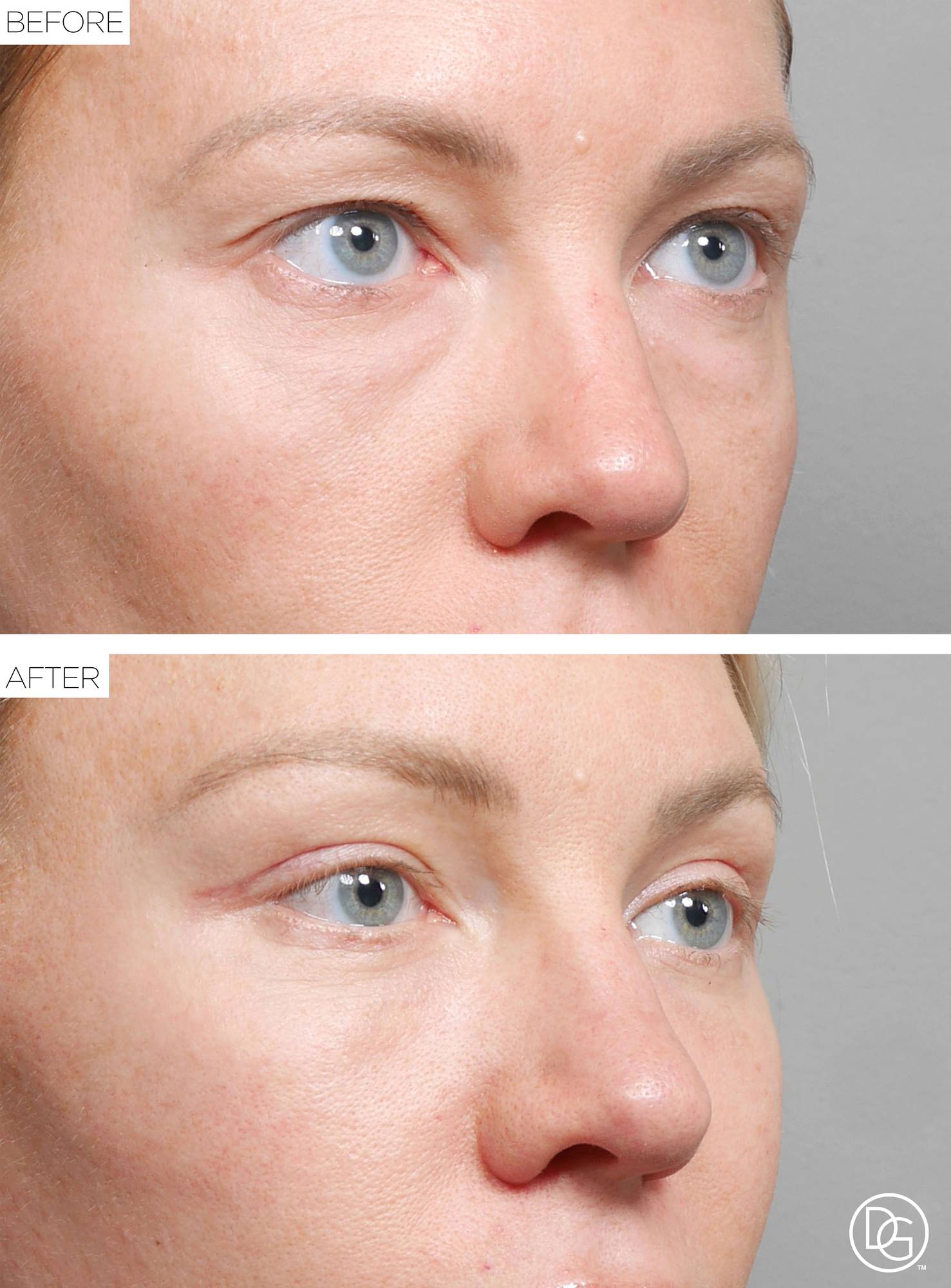 Before & After Image