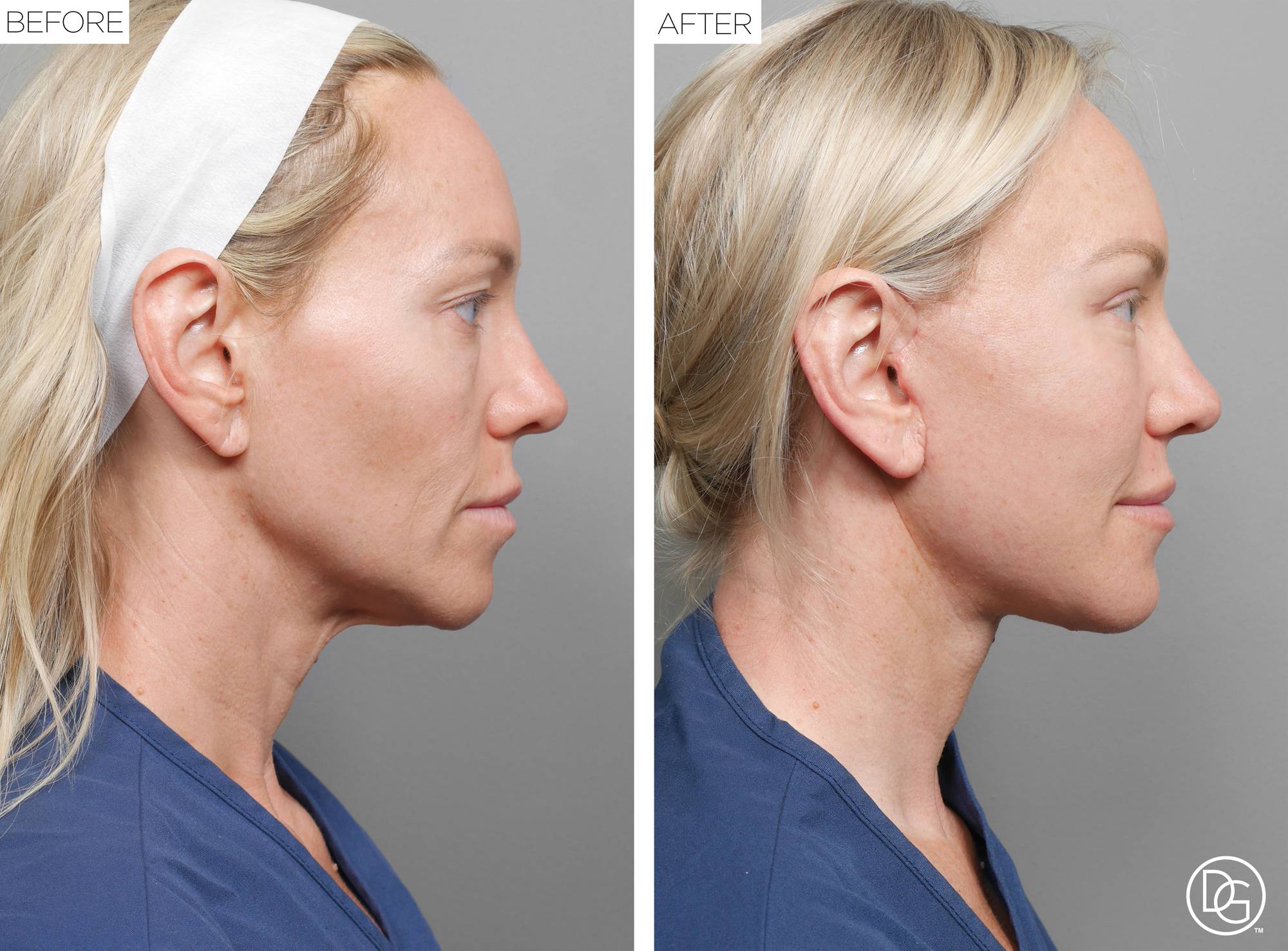 Before & After Image