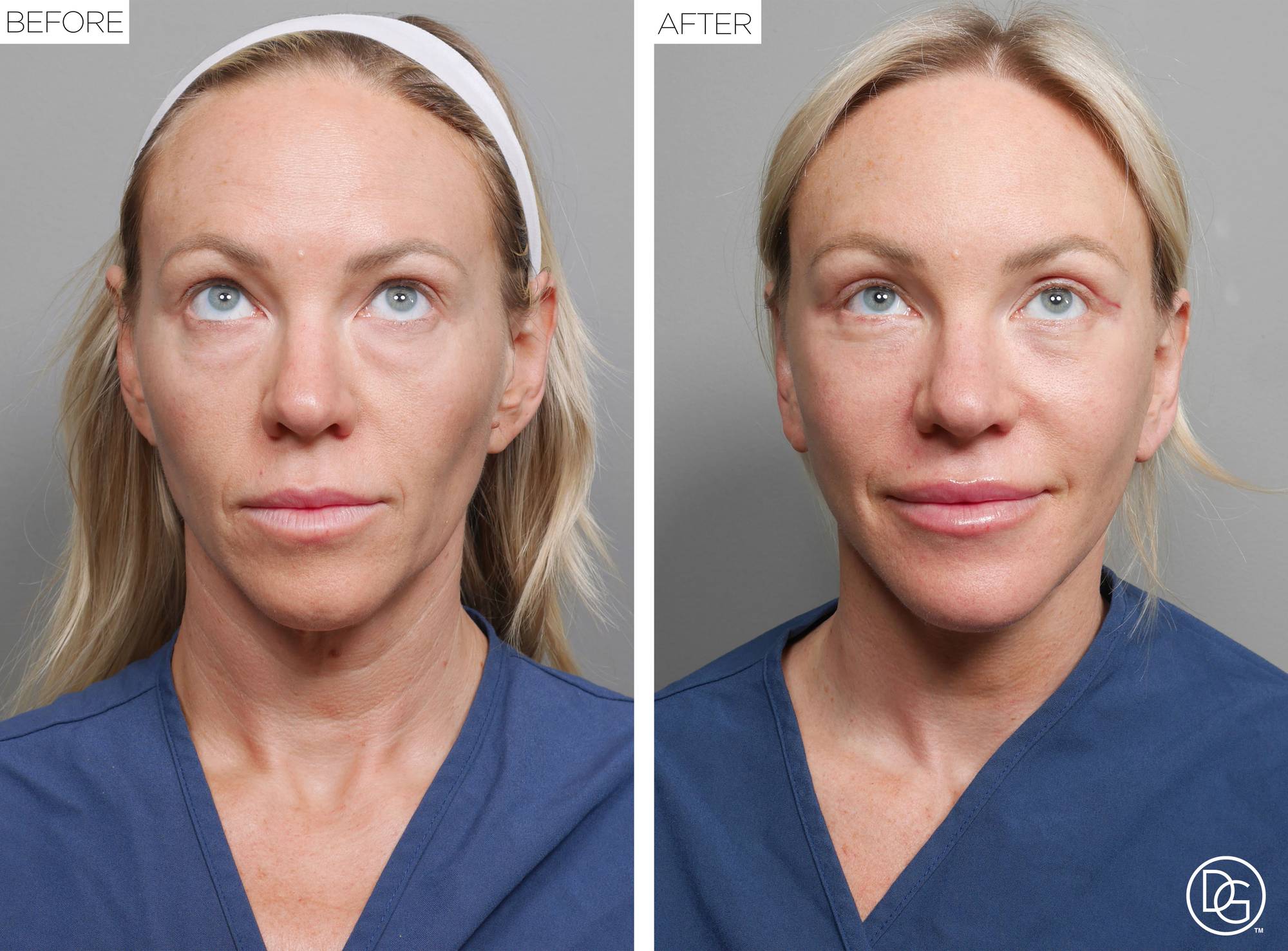 Before & After Image