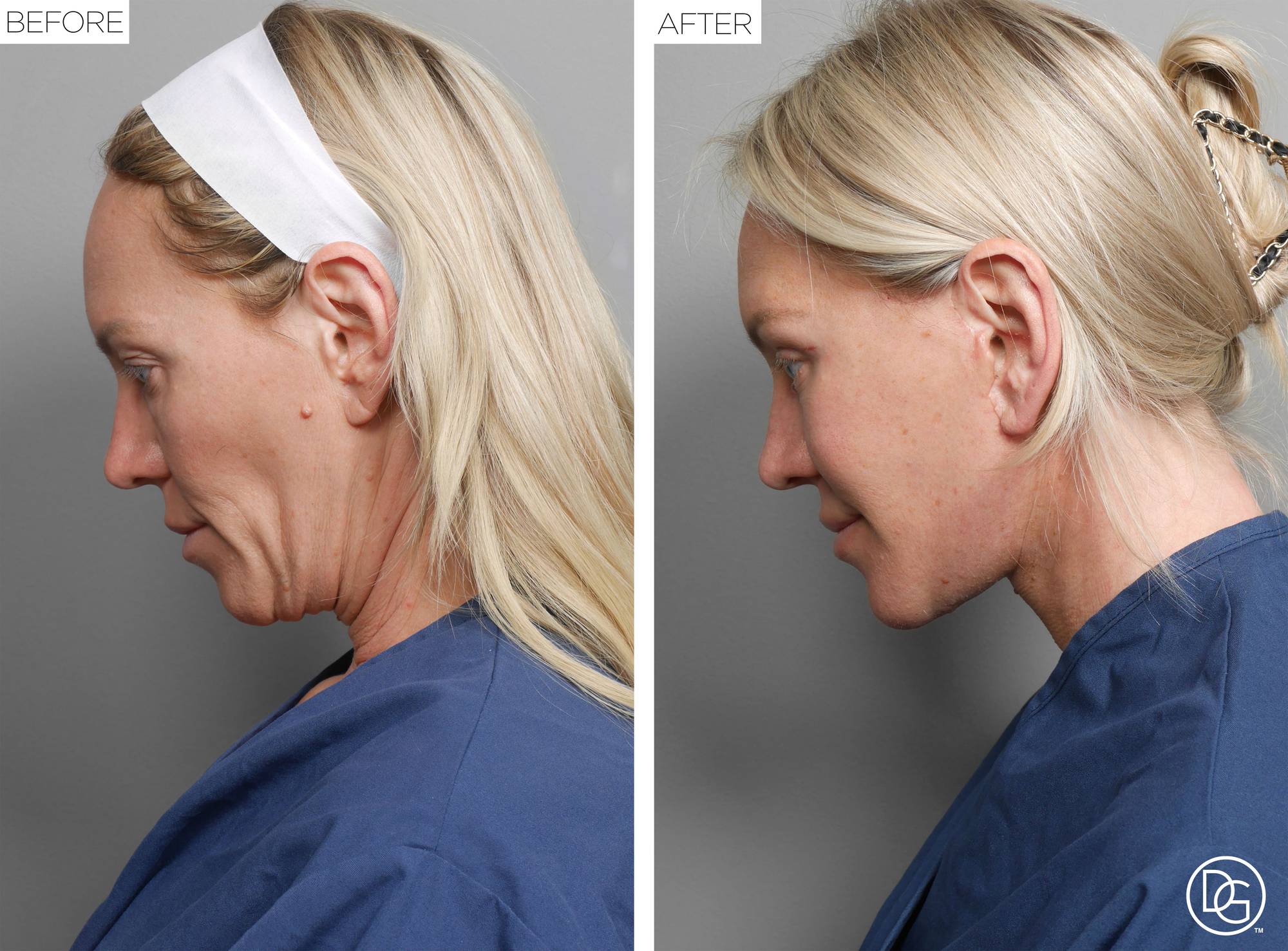 Before & After Image