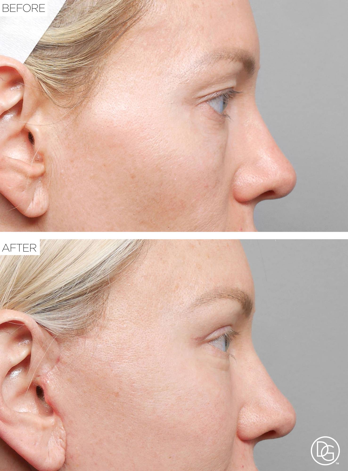 Before & After Image