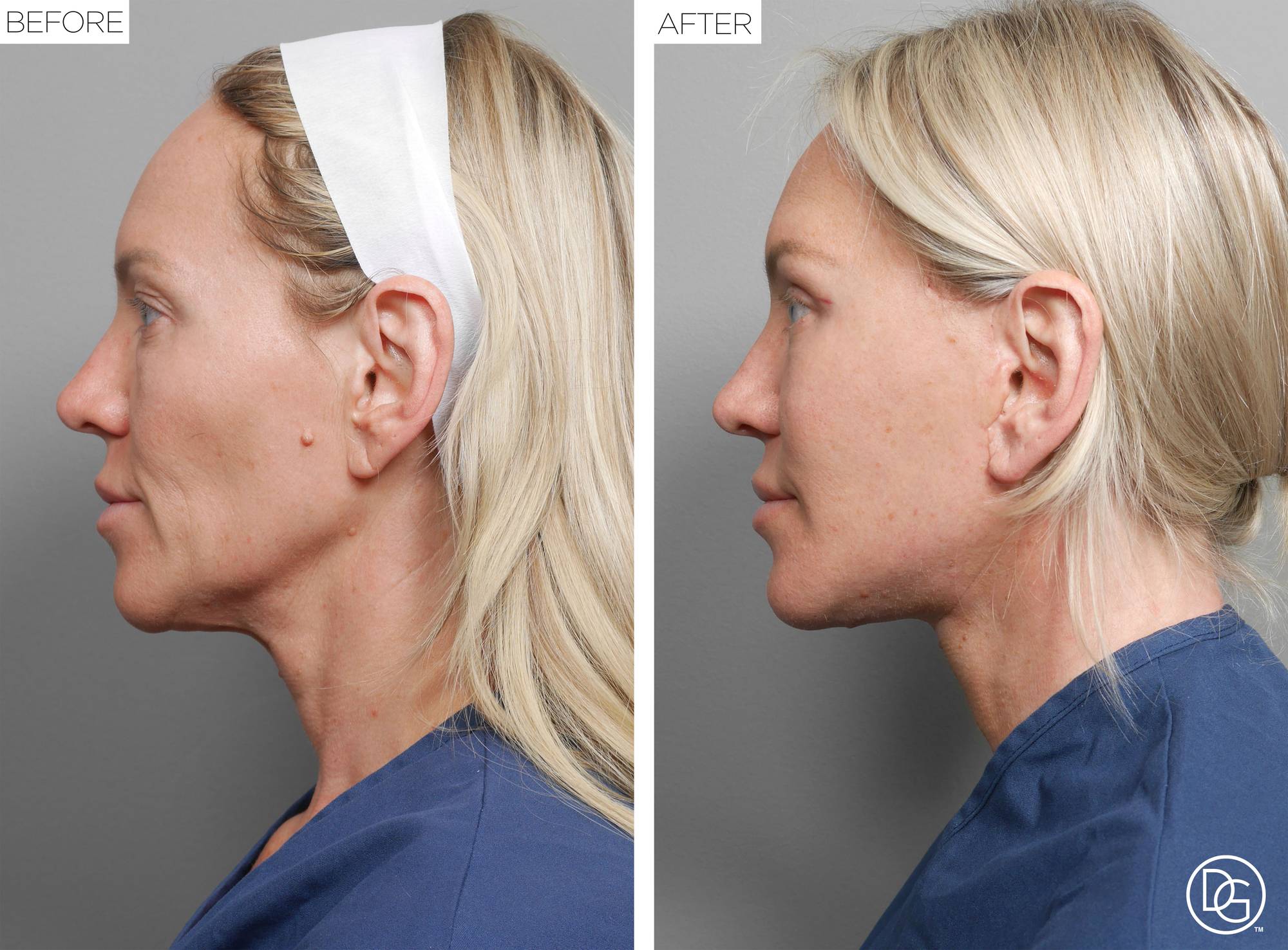 Before & After Image
