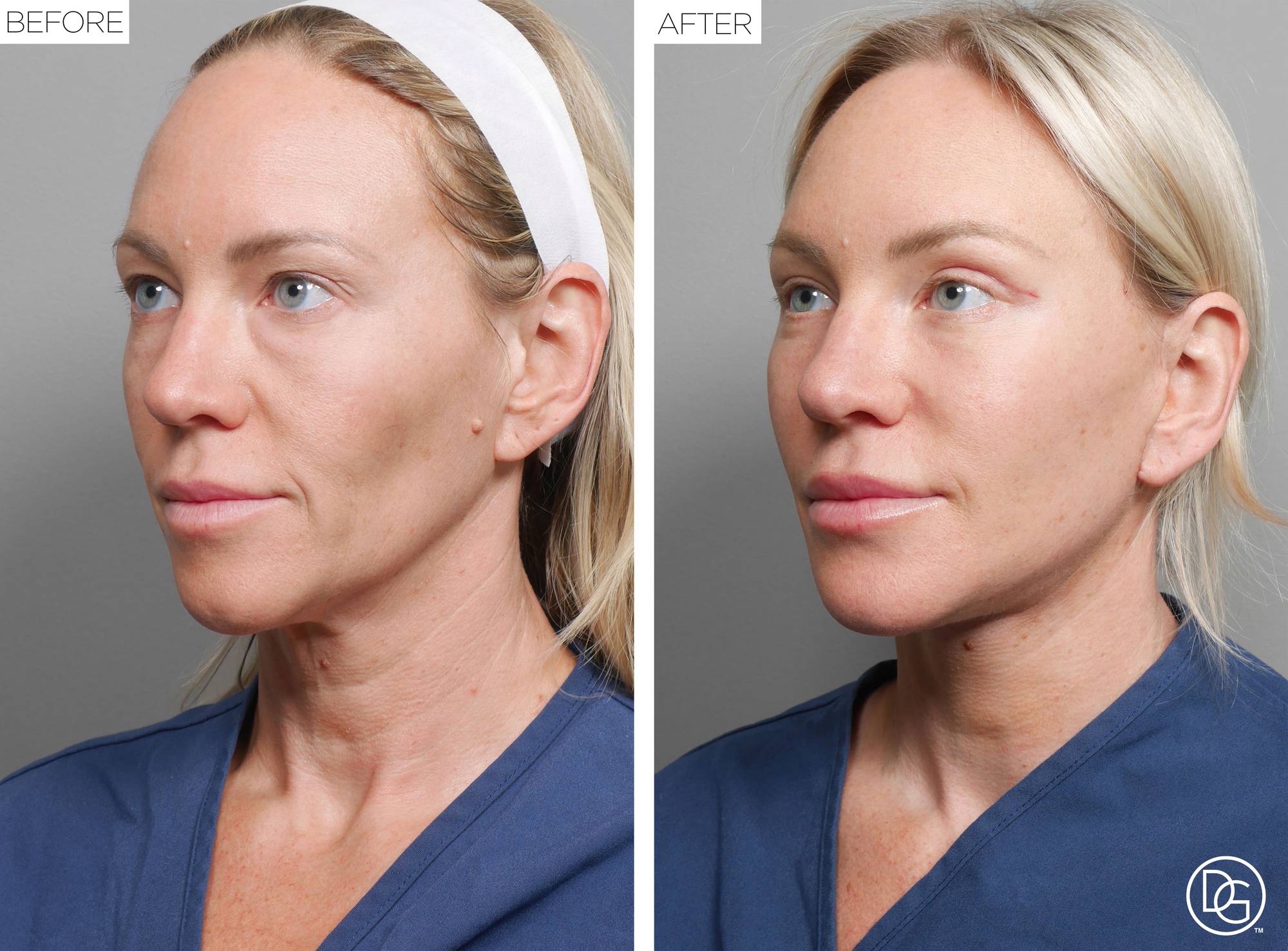 Before & After Image
