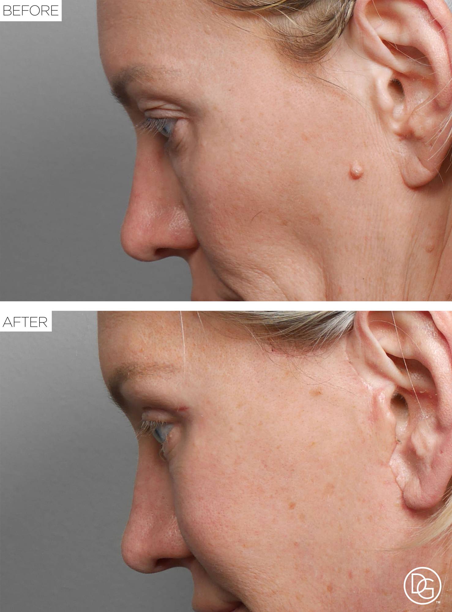 Before & After Image