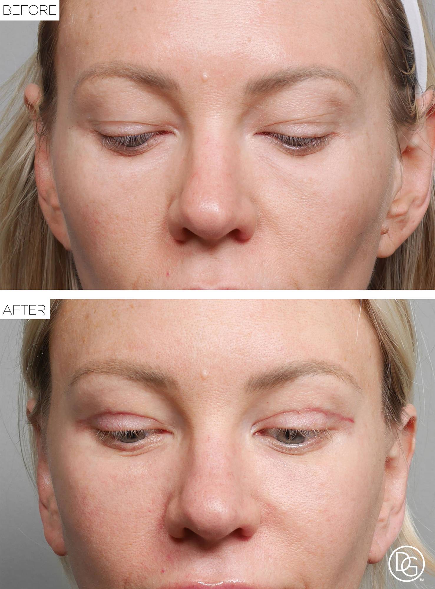 Before & After Image