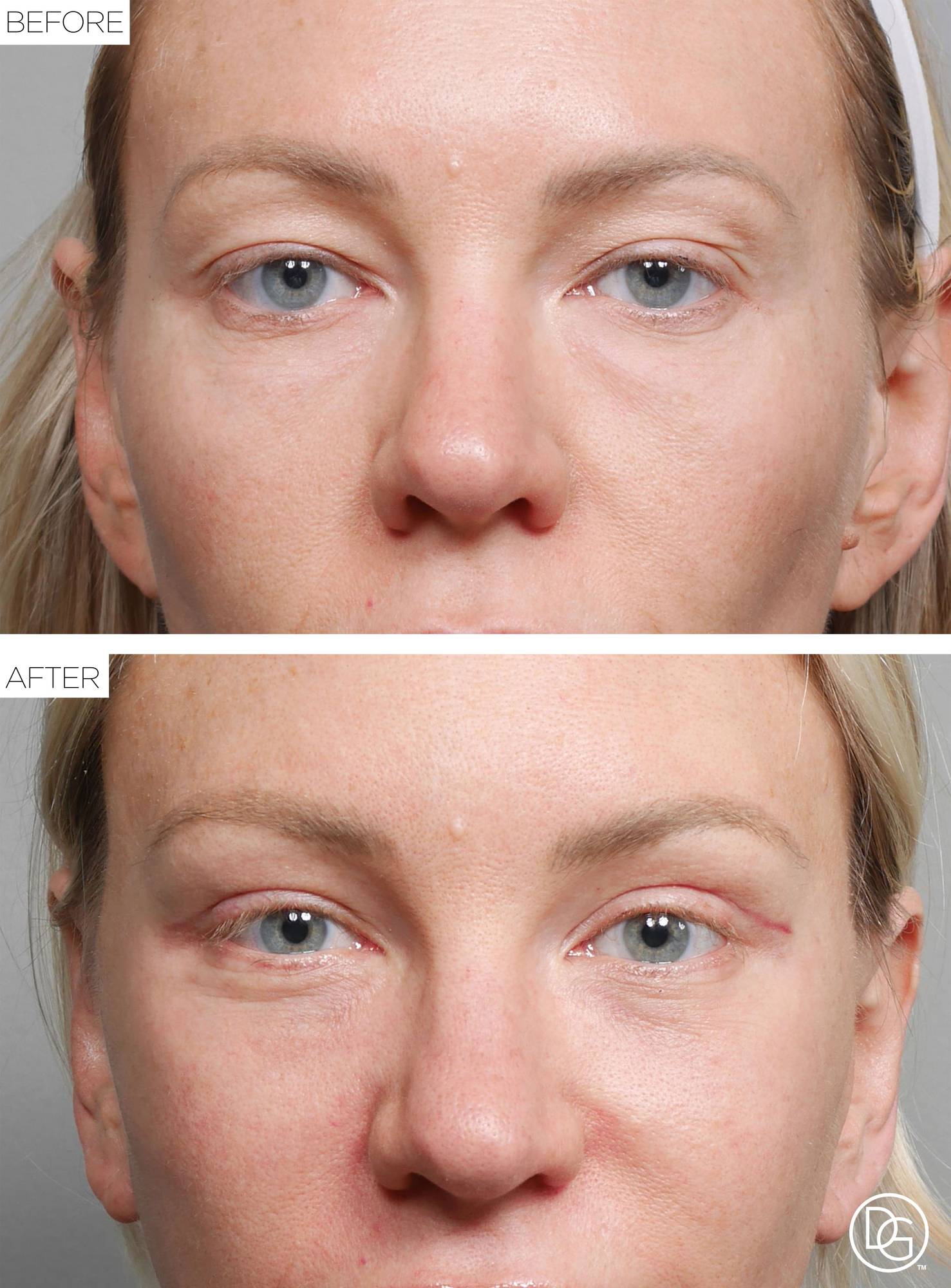Before & After Image