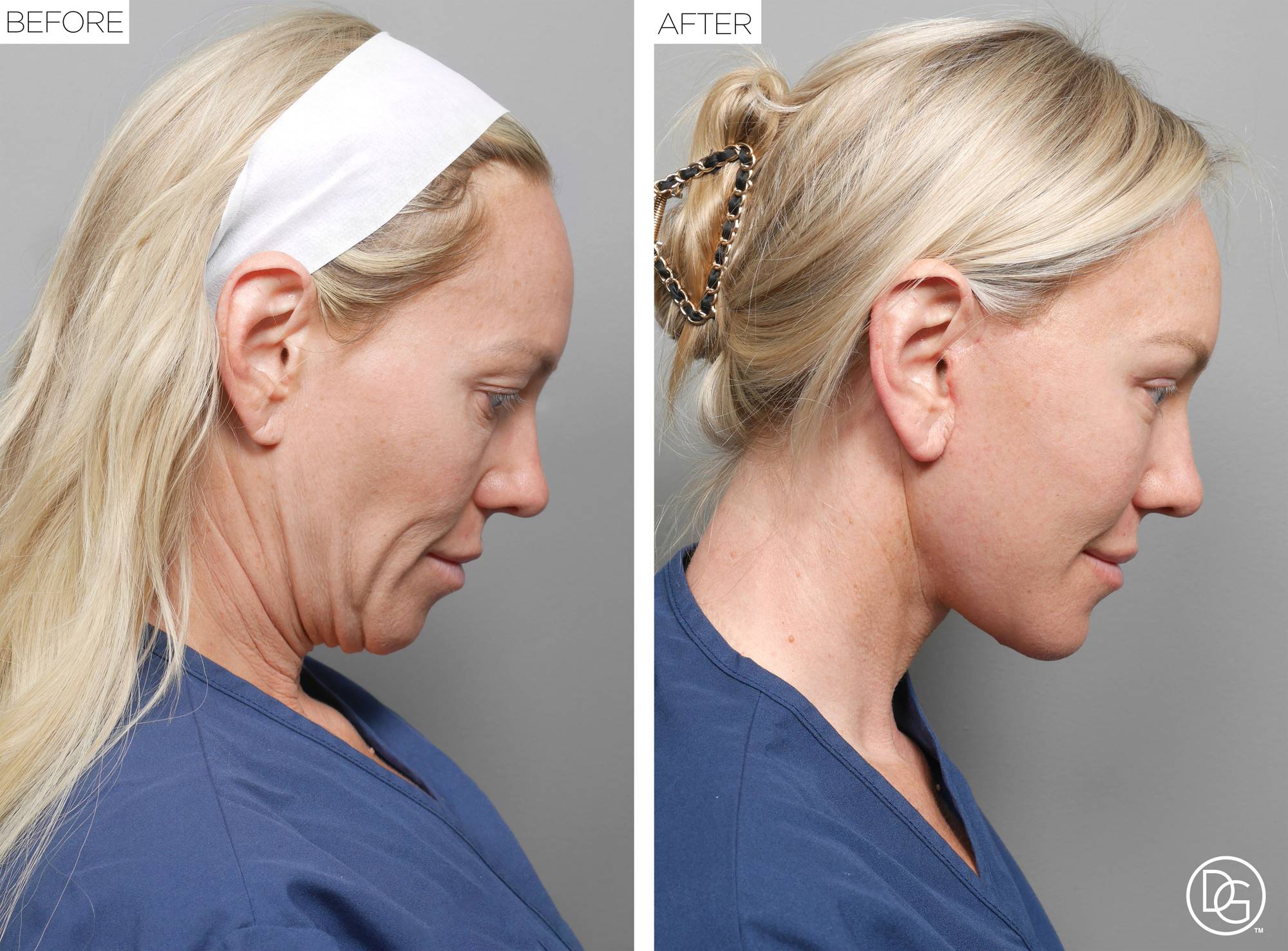 Before & After Image
