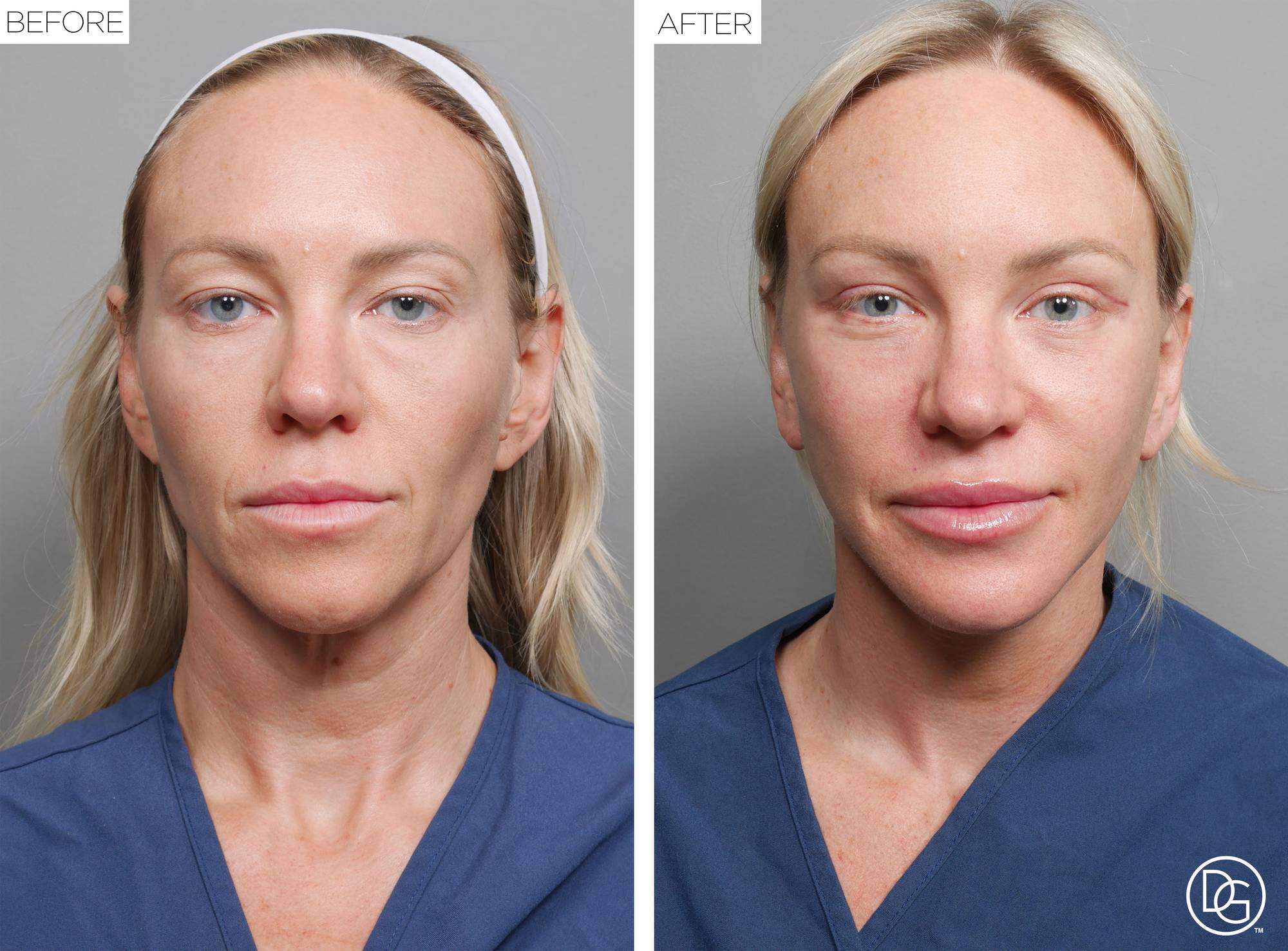 Before & After Image