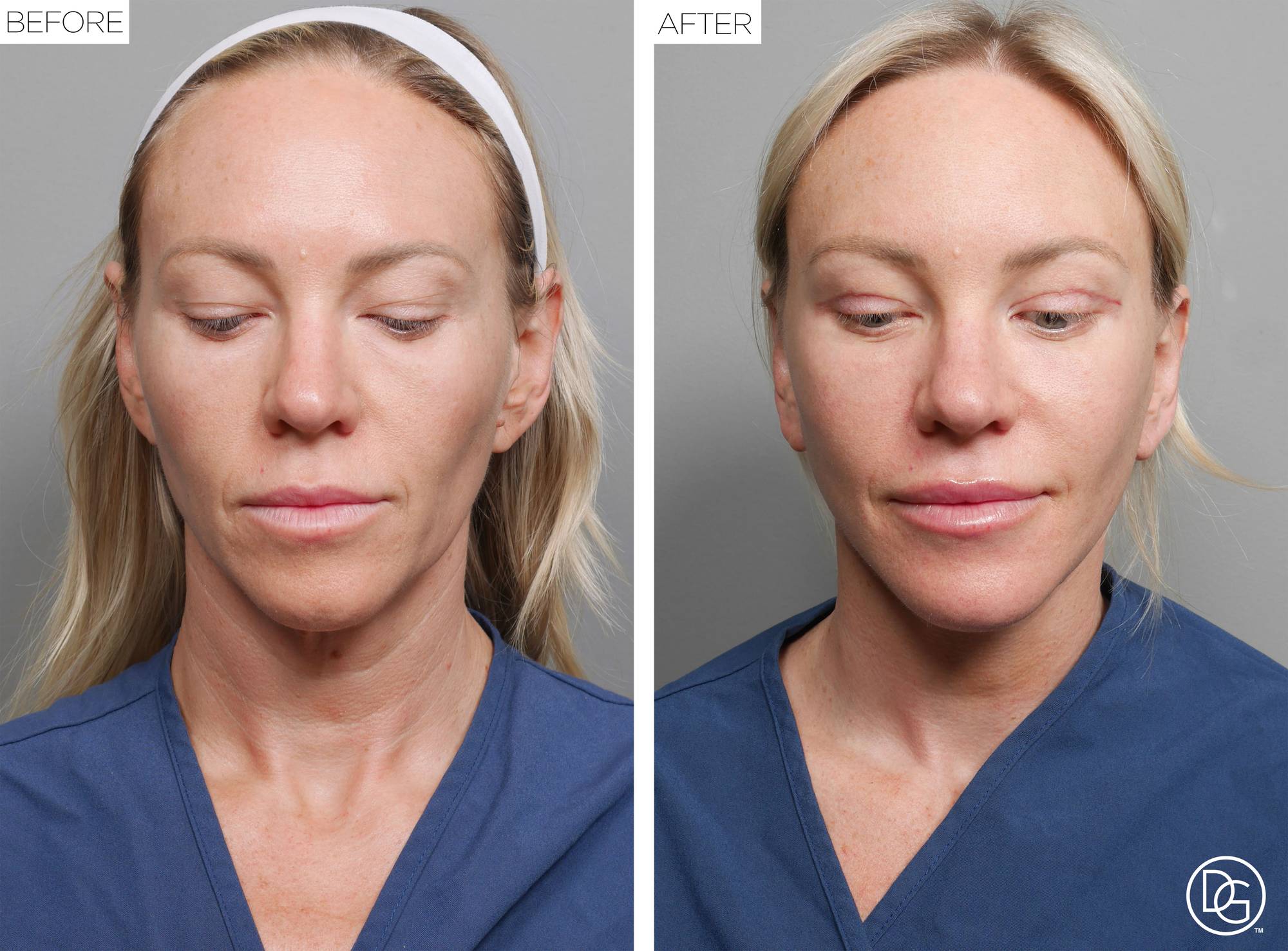Before & After Image