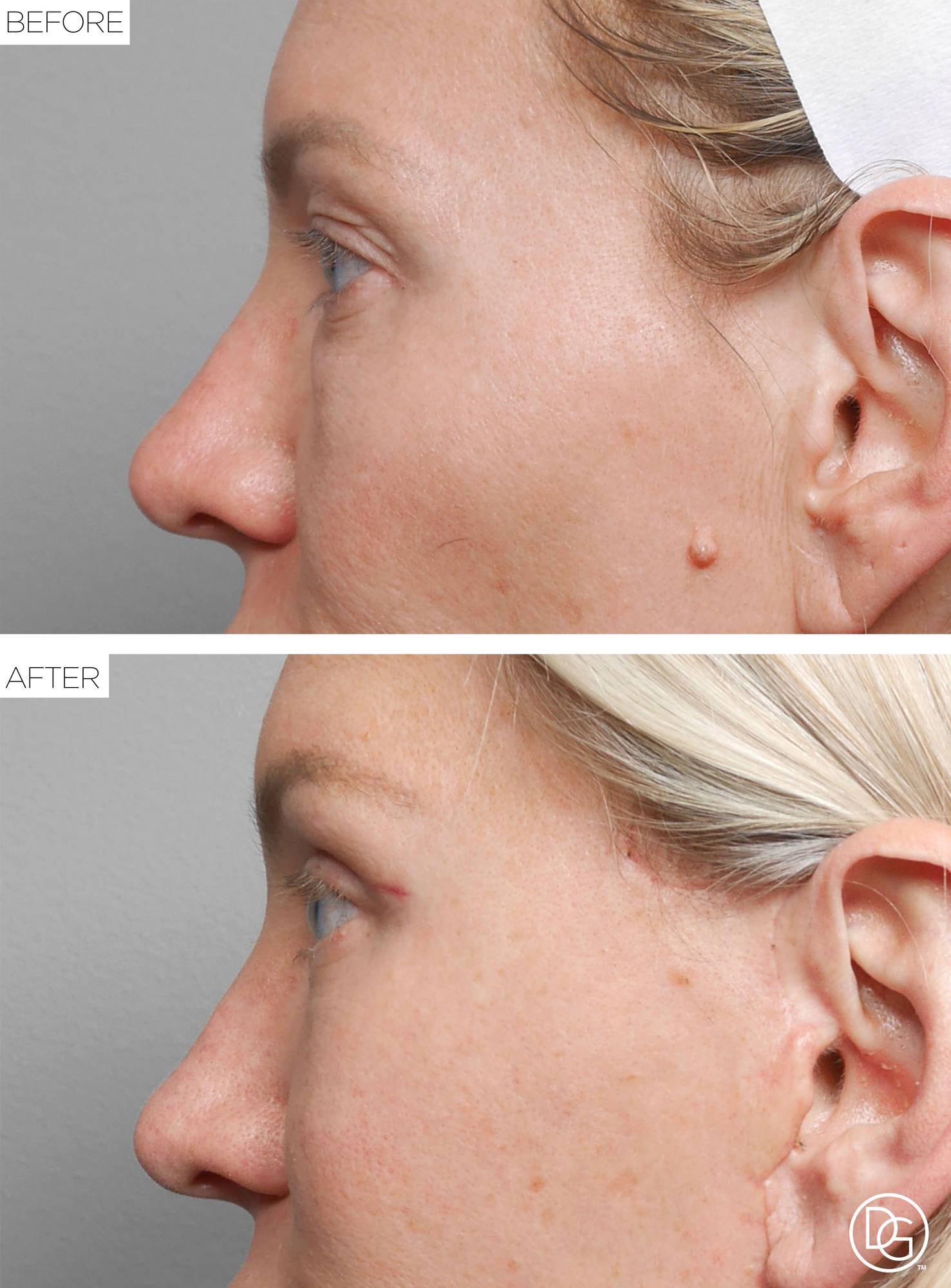 Before & After Image
