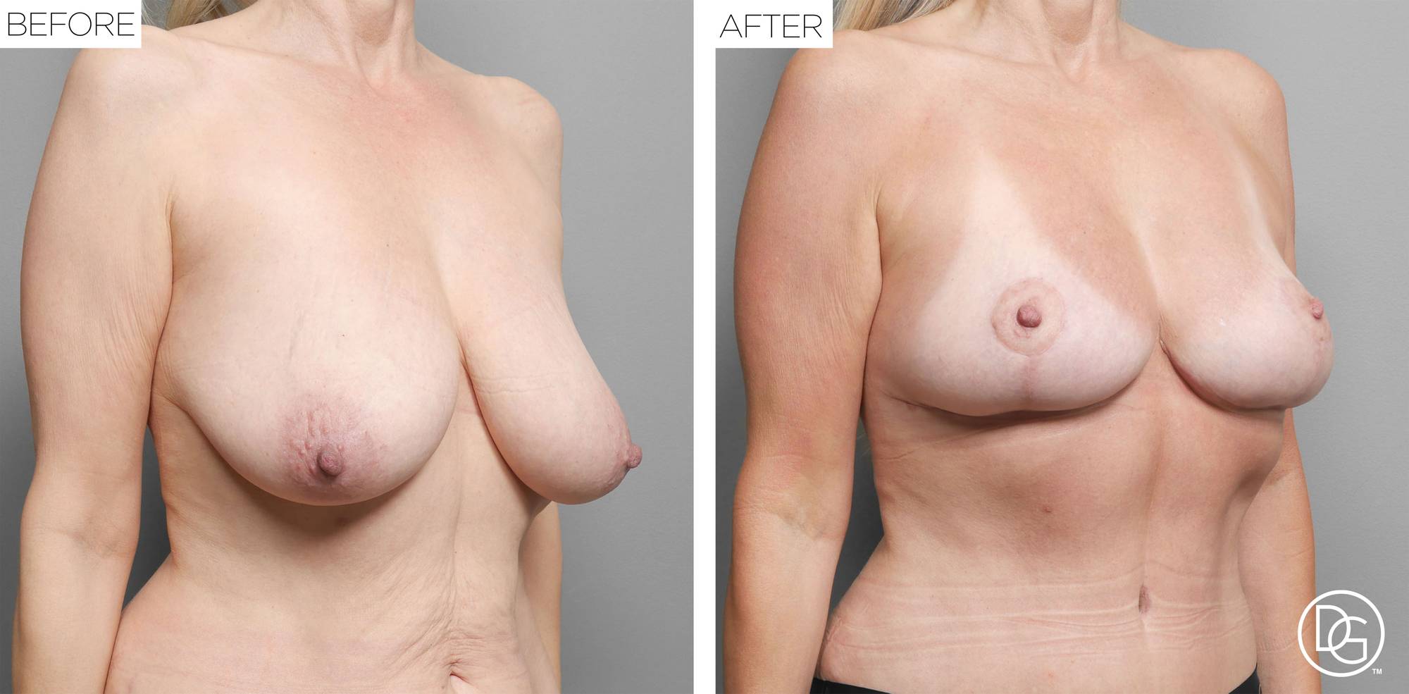 Before & After Image