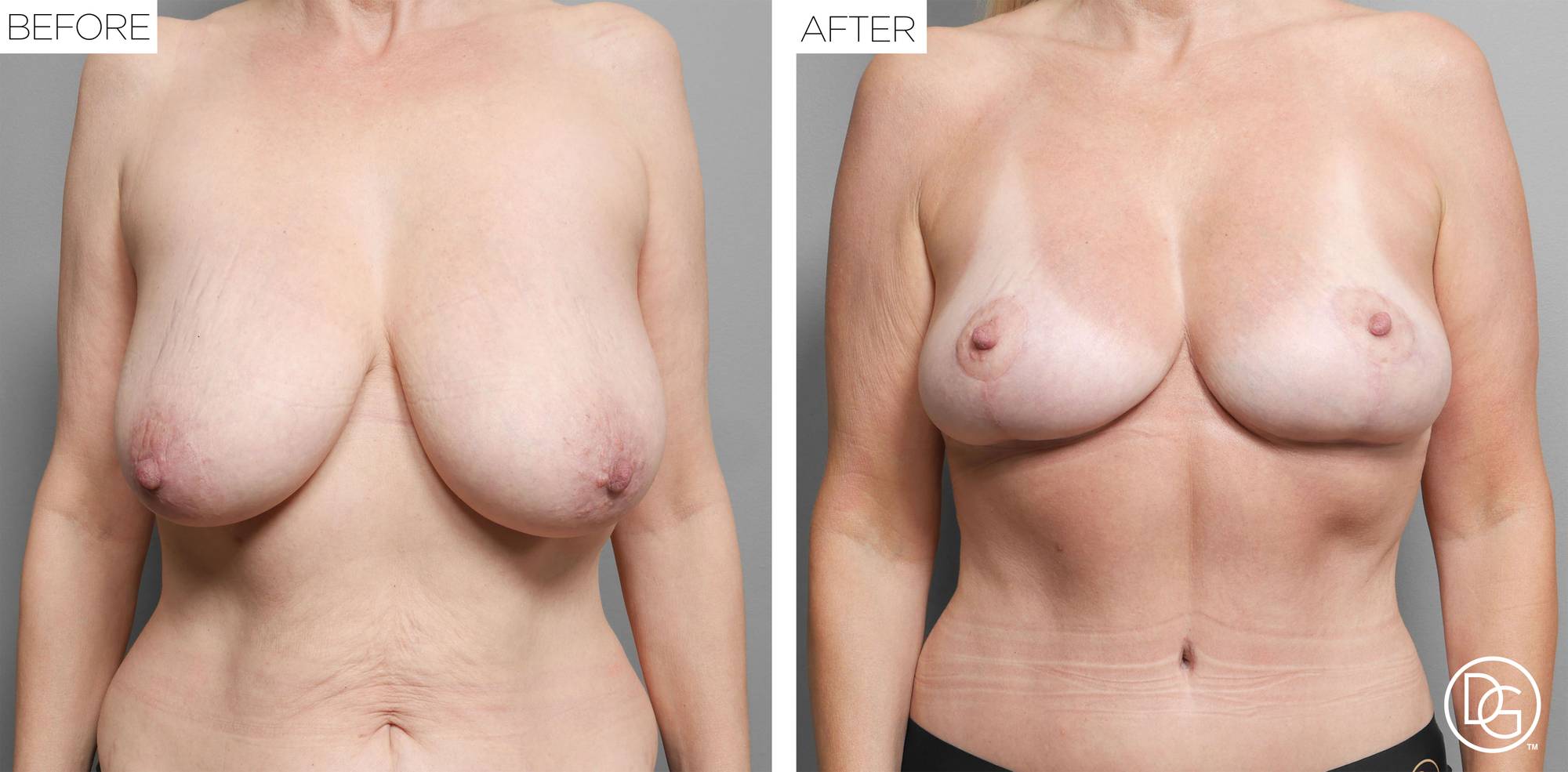 Before & After Image