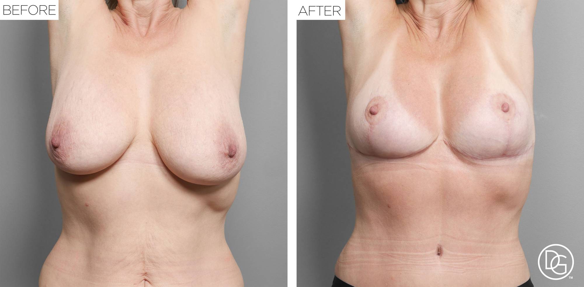 Before & After Image