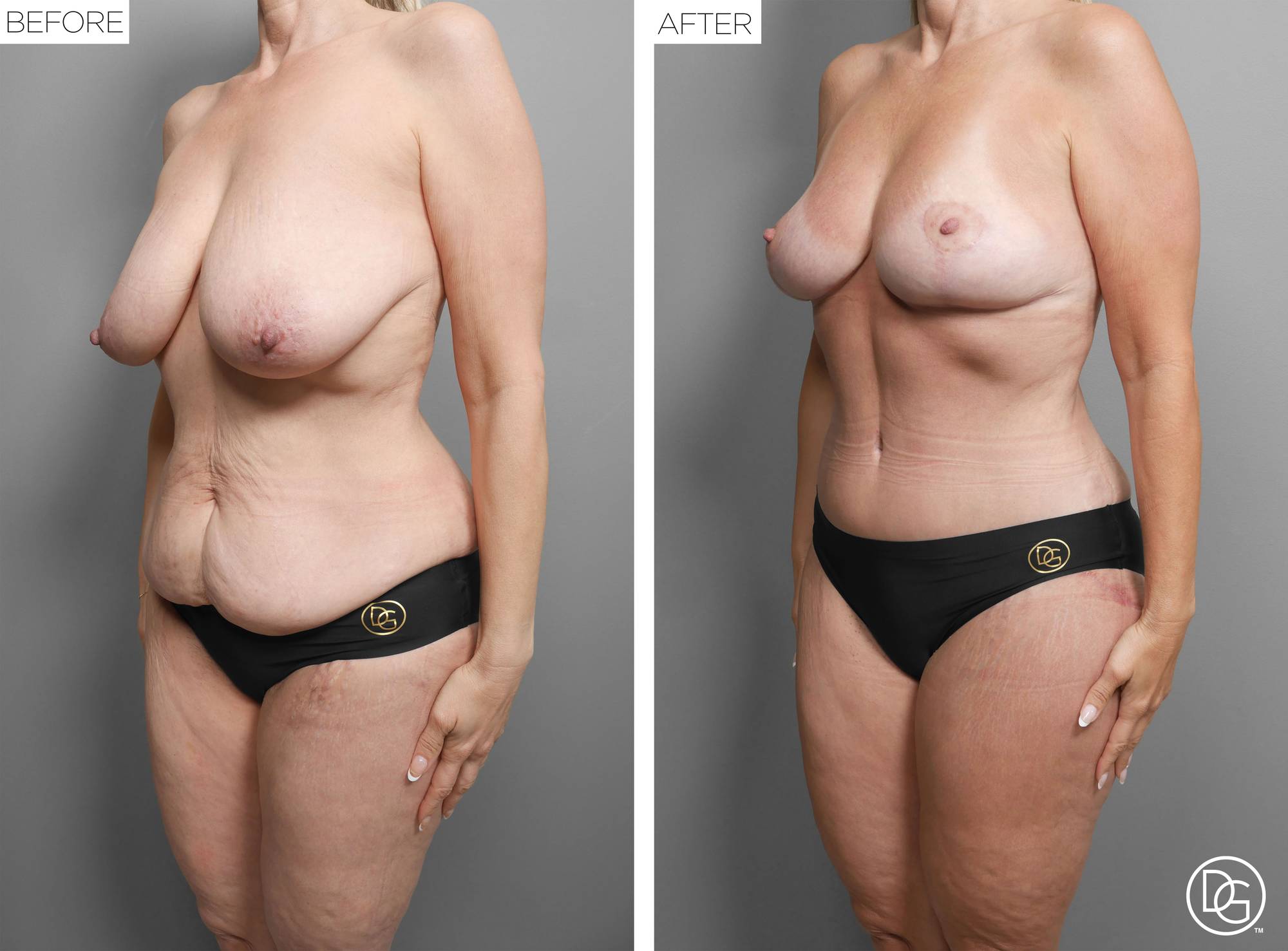 Before & After Image