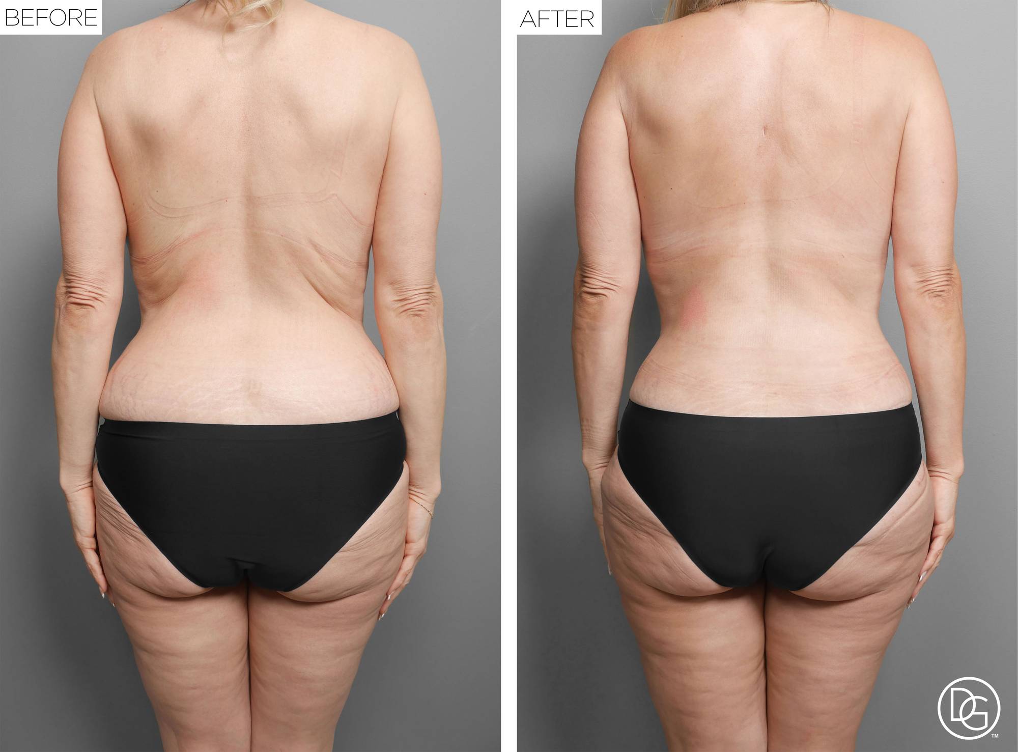 Before & After Image