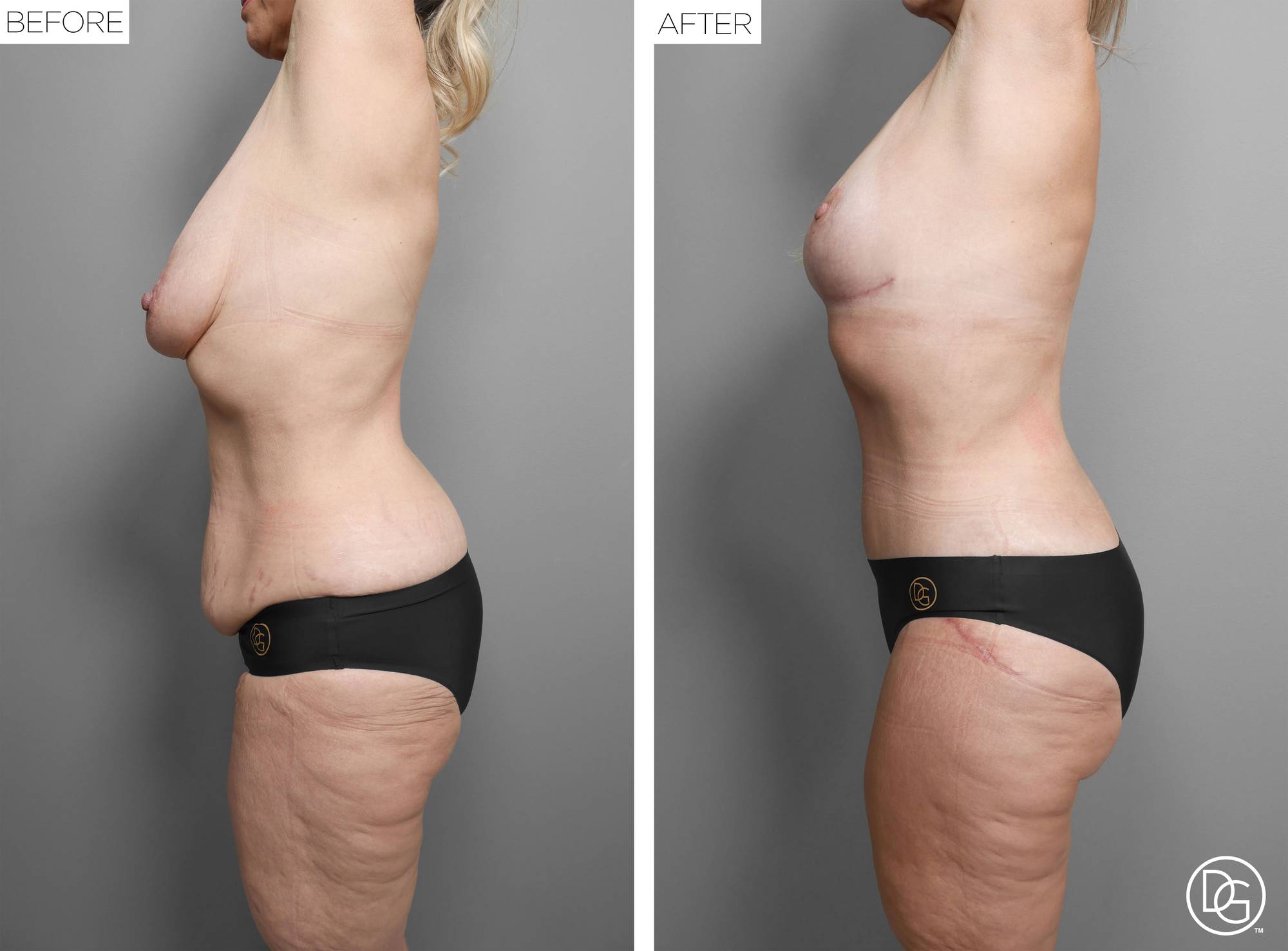 Before & After Image