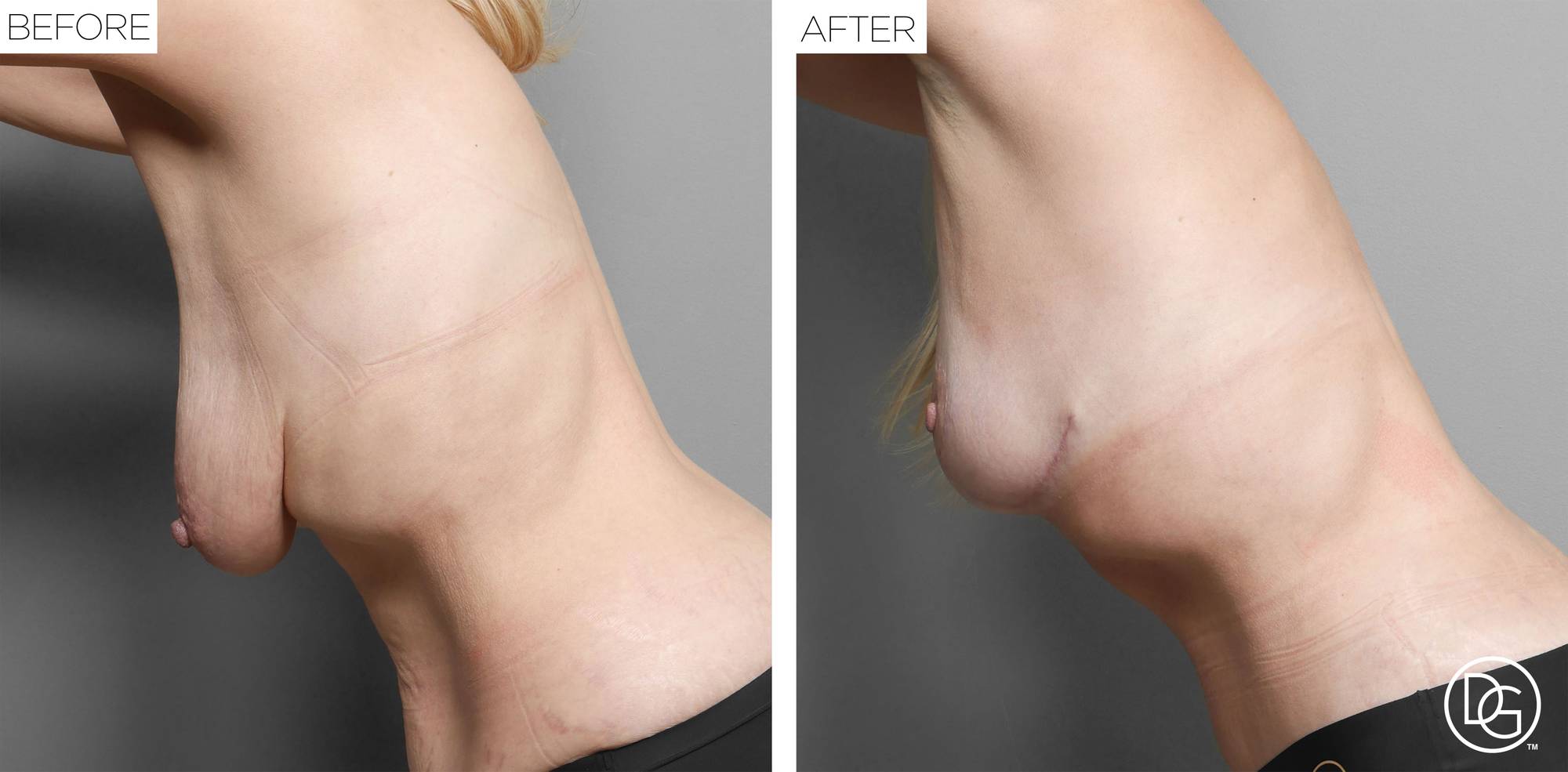 Before & After Image