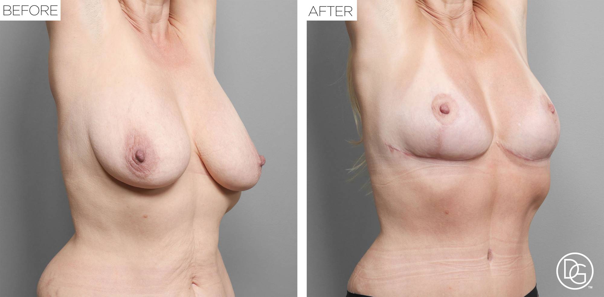Before & After Image