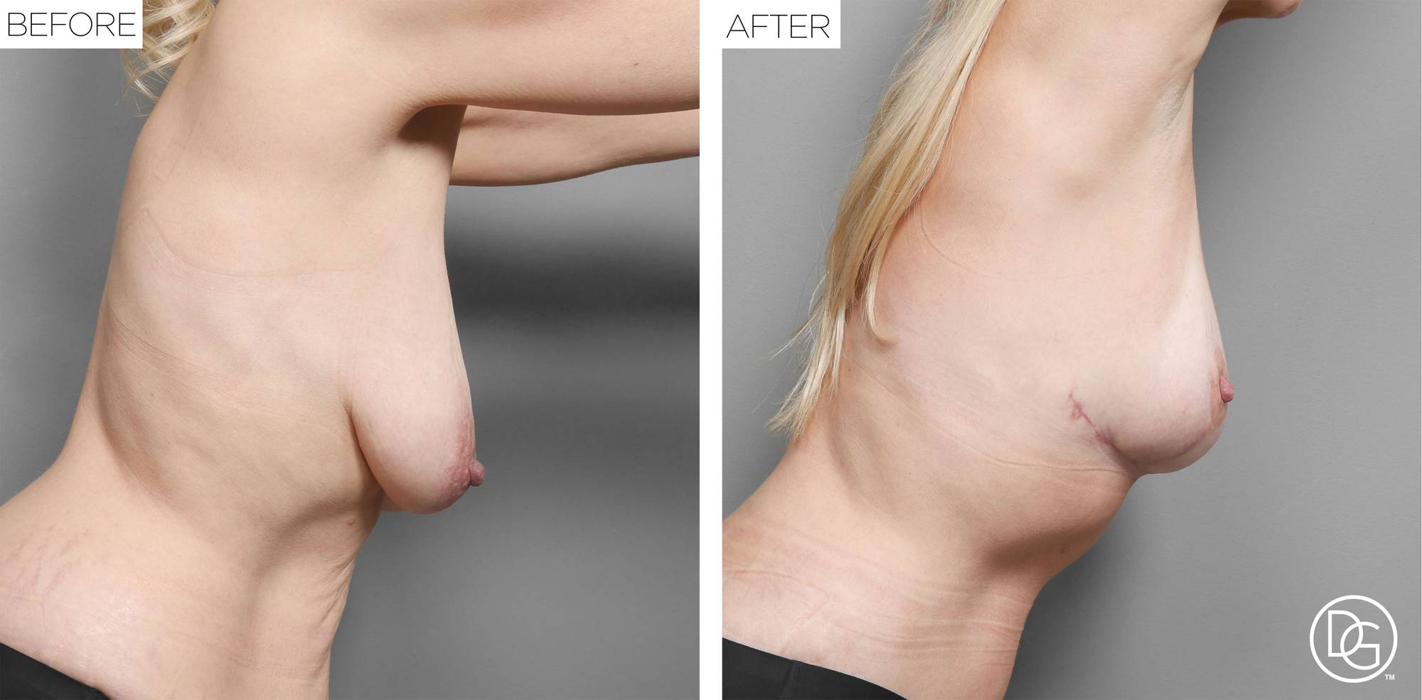 Before & After Image