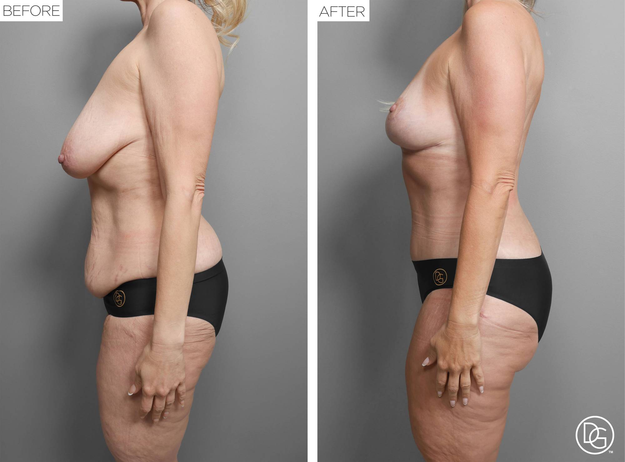 Before & After Image