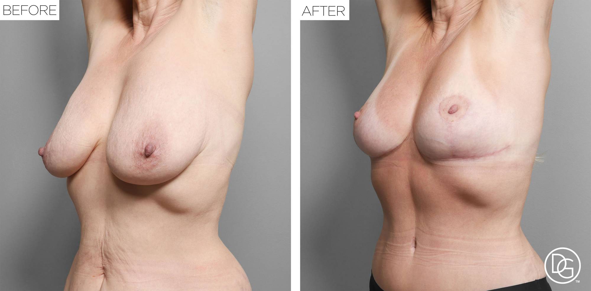 Before & After Image