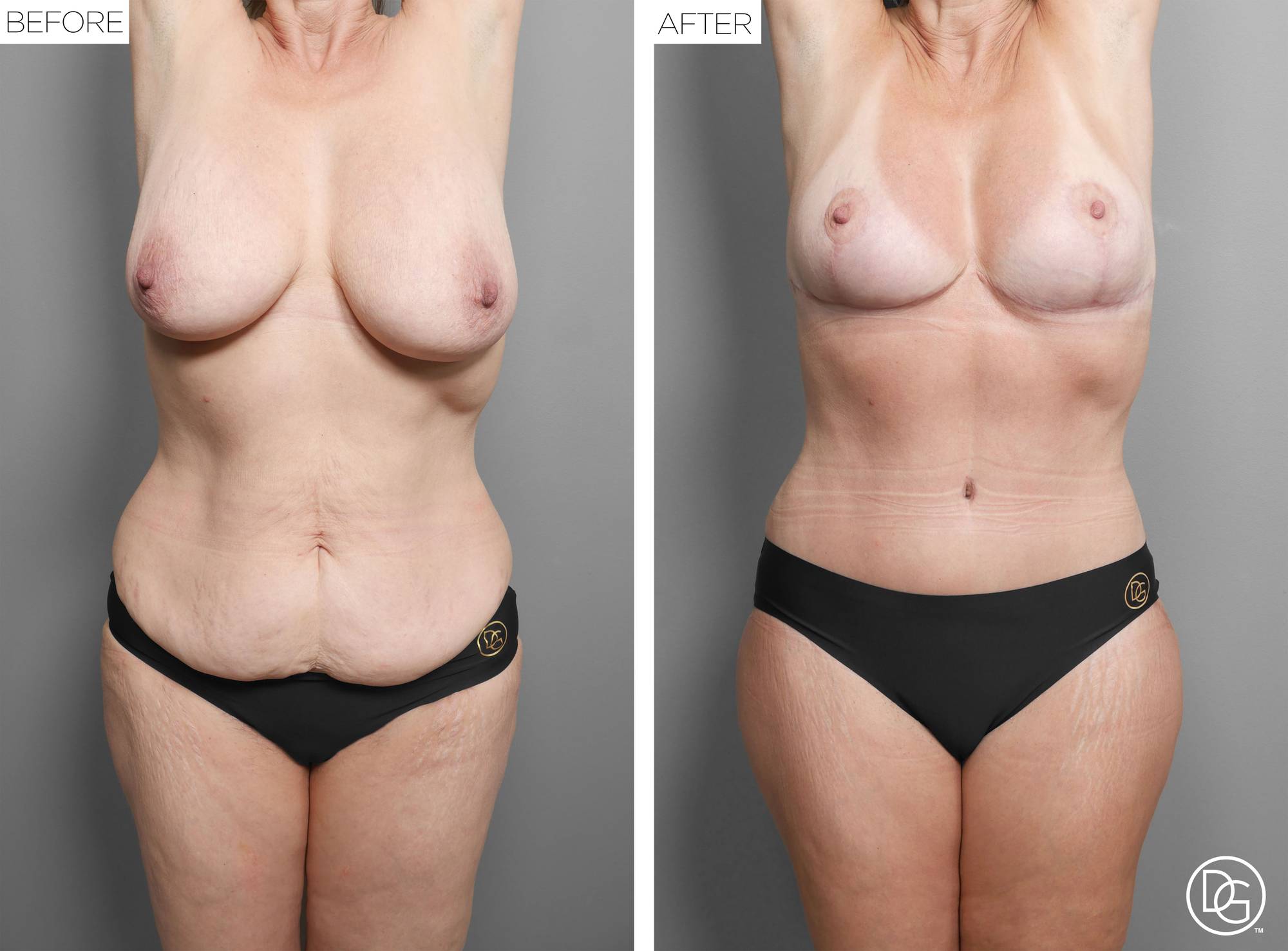 Before & After Image